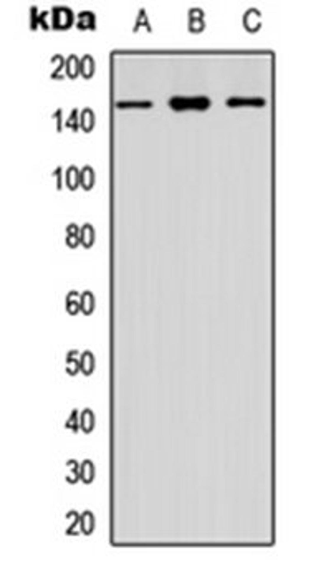 Western blot analysis of HEK293T (Lane 1), Raw264.7 (Lane 2), PC12 (Lane 3) whole cell lysates using CYFIP1 antibody