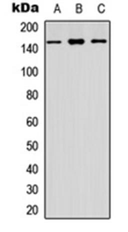 Western blot analysis of HEK293T (Lane 1), Raw264.7 (Lane 2), PC12 (Lane 3) whole cell lysates using CYFIP1 antibody