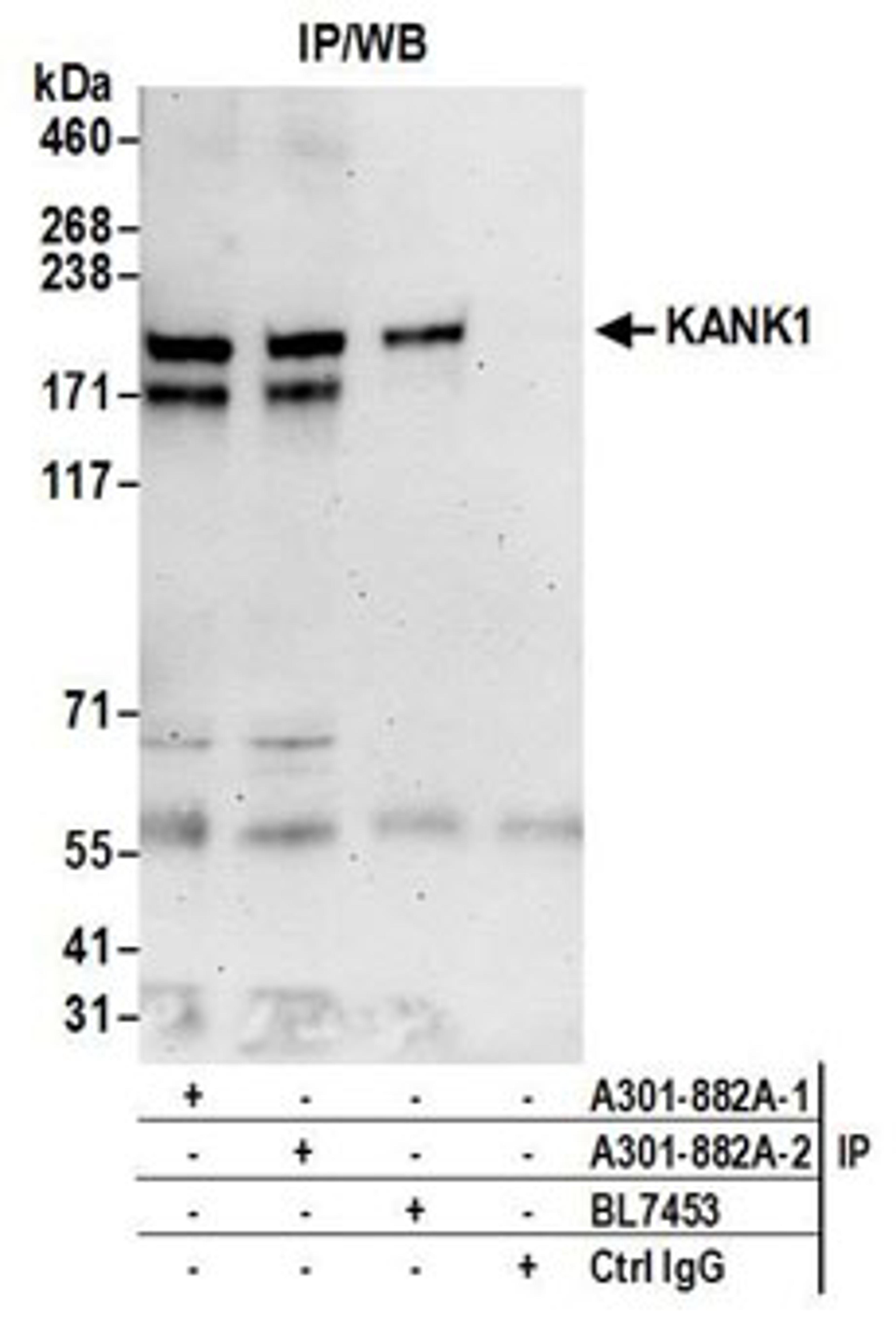 Detection of human KANK1 by western blot of immunoprecipitates.