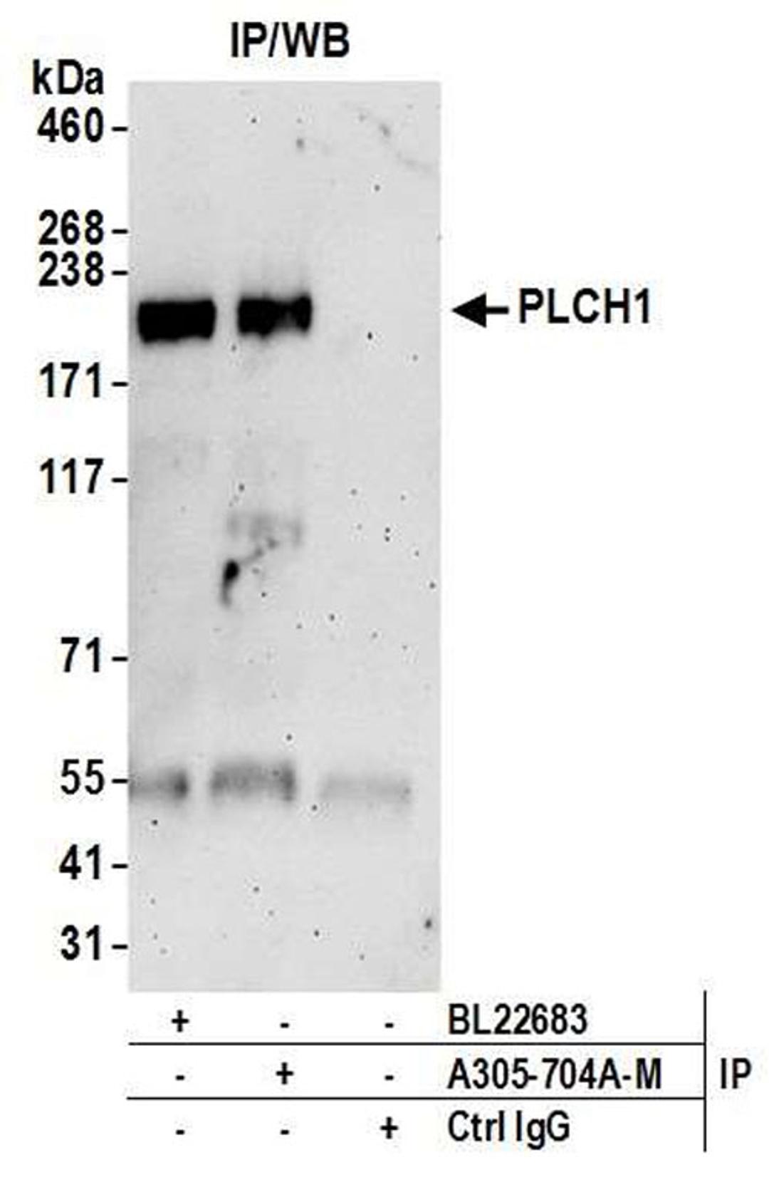 Detection of human PLCH1 by WB of IP.