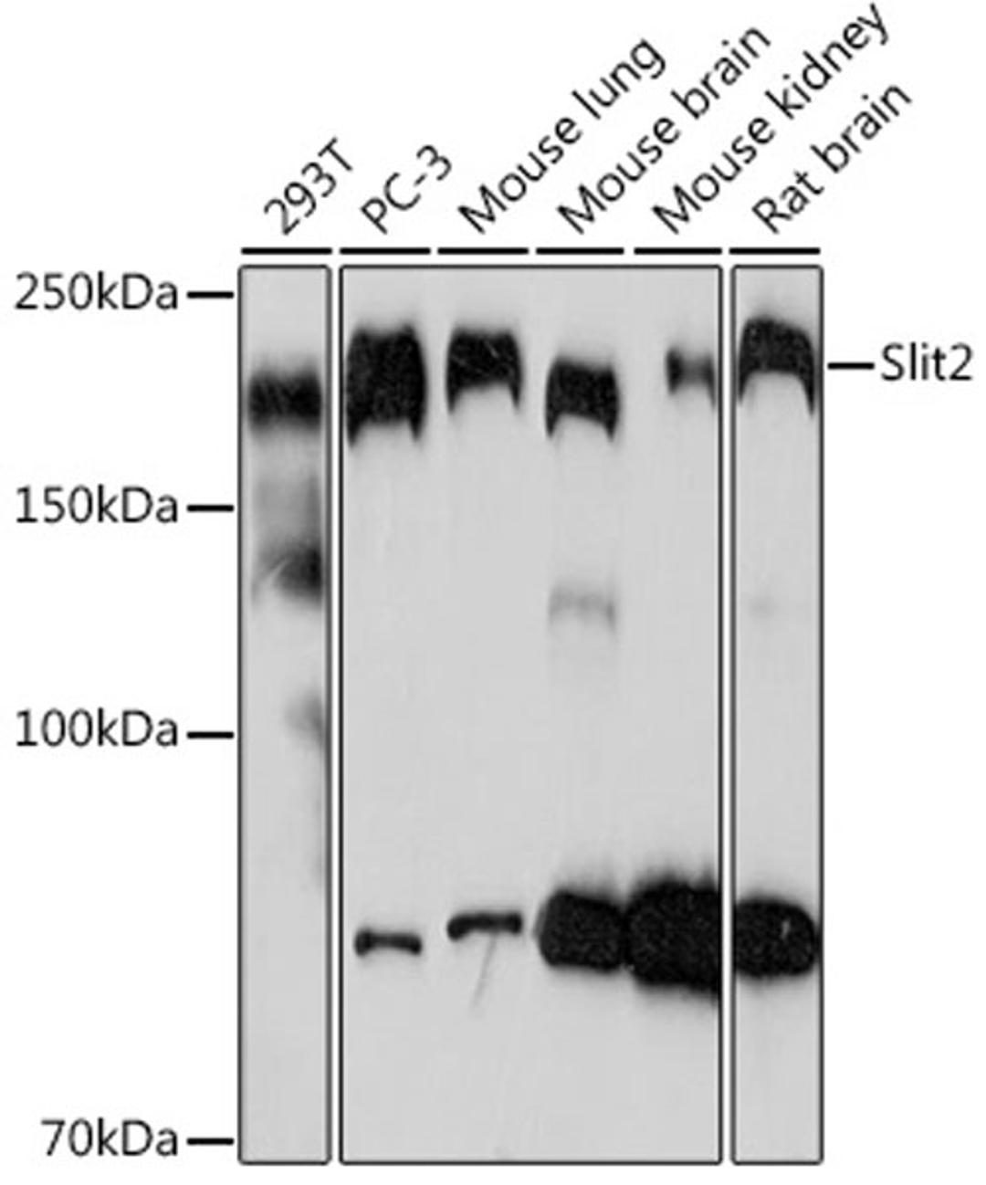Western blot - Slit2 Rabbit mAb (A3467)
