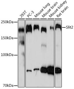 Western blot - Slit2 Rabbit mAb (A3467)