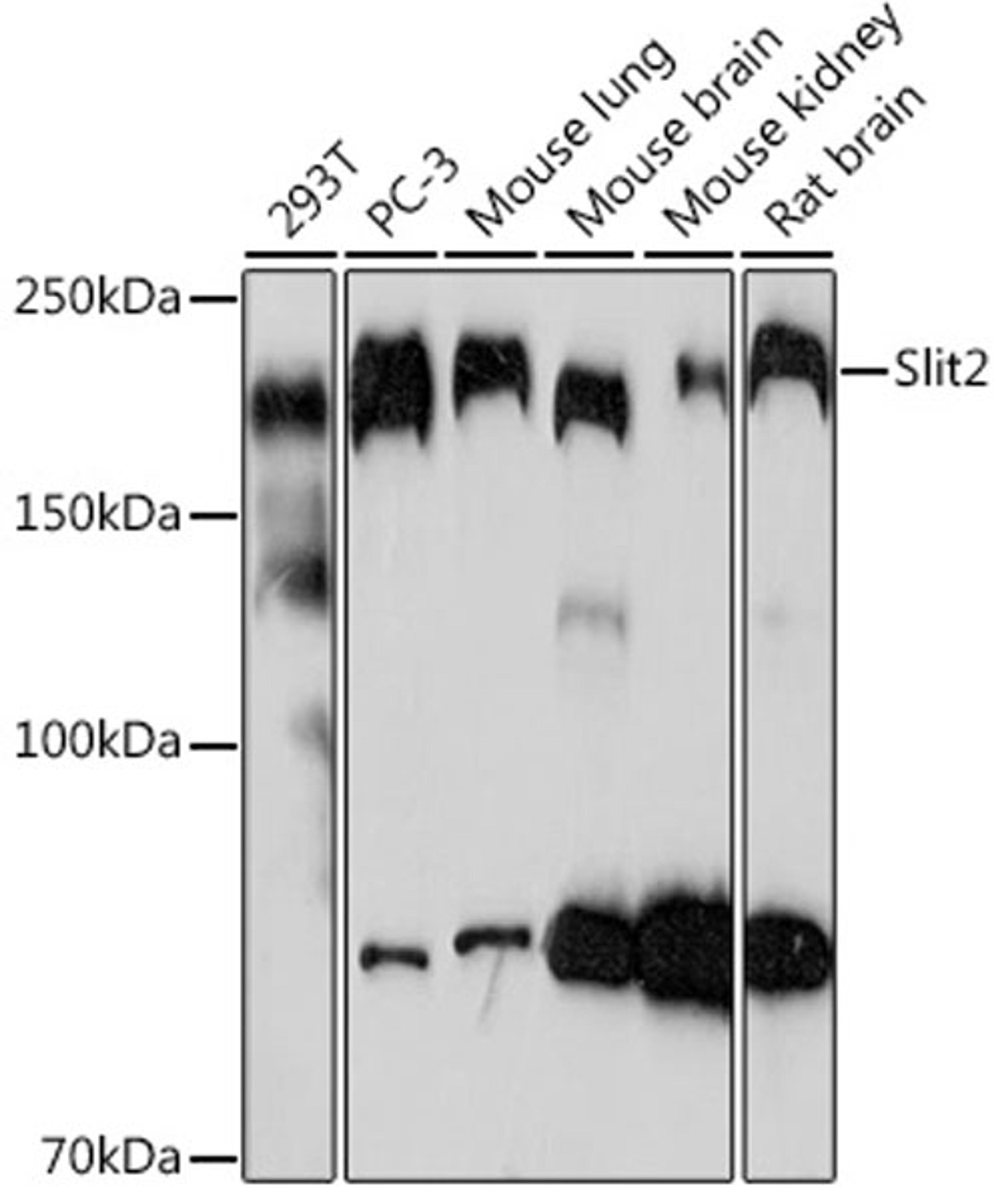 Western blot - Slit2 Rabbit mAb (A3467)