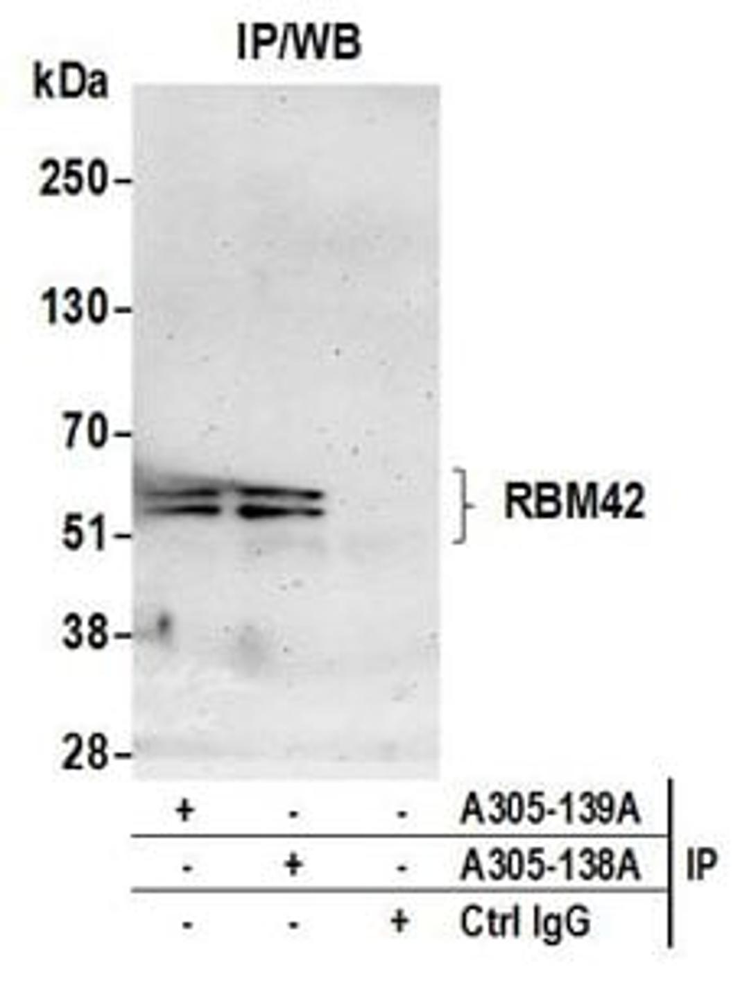 Detection of human RBM42 by western blot of immunoprecipitates.