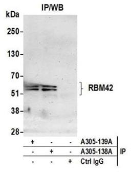 Detection of human RBM42 by western blot of immunoprecipitates.