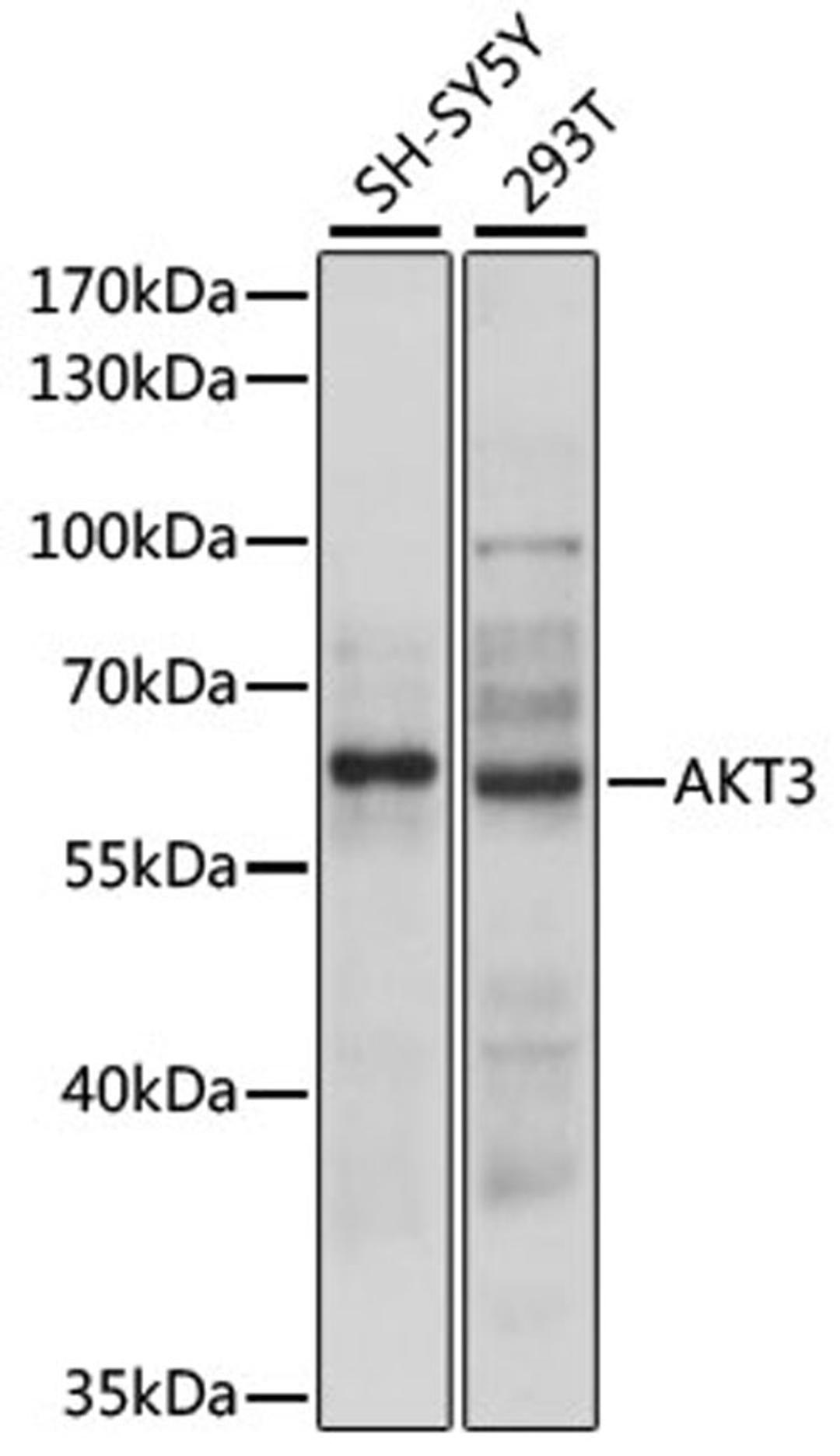 Western blot - AKT3 antibody (A12909)