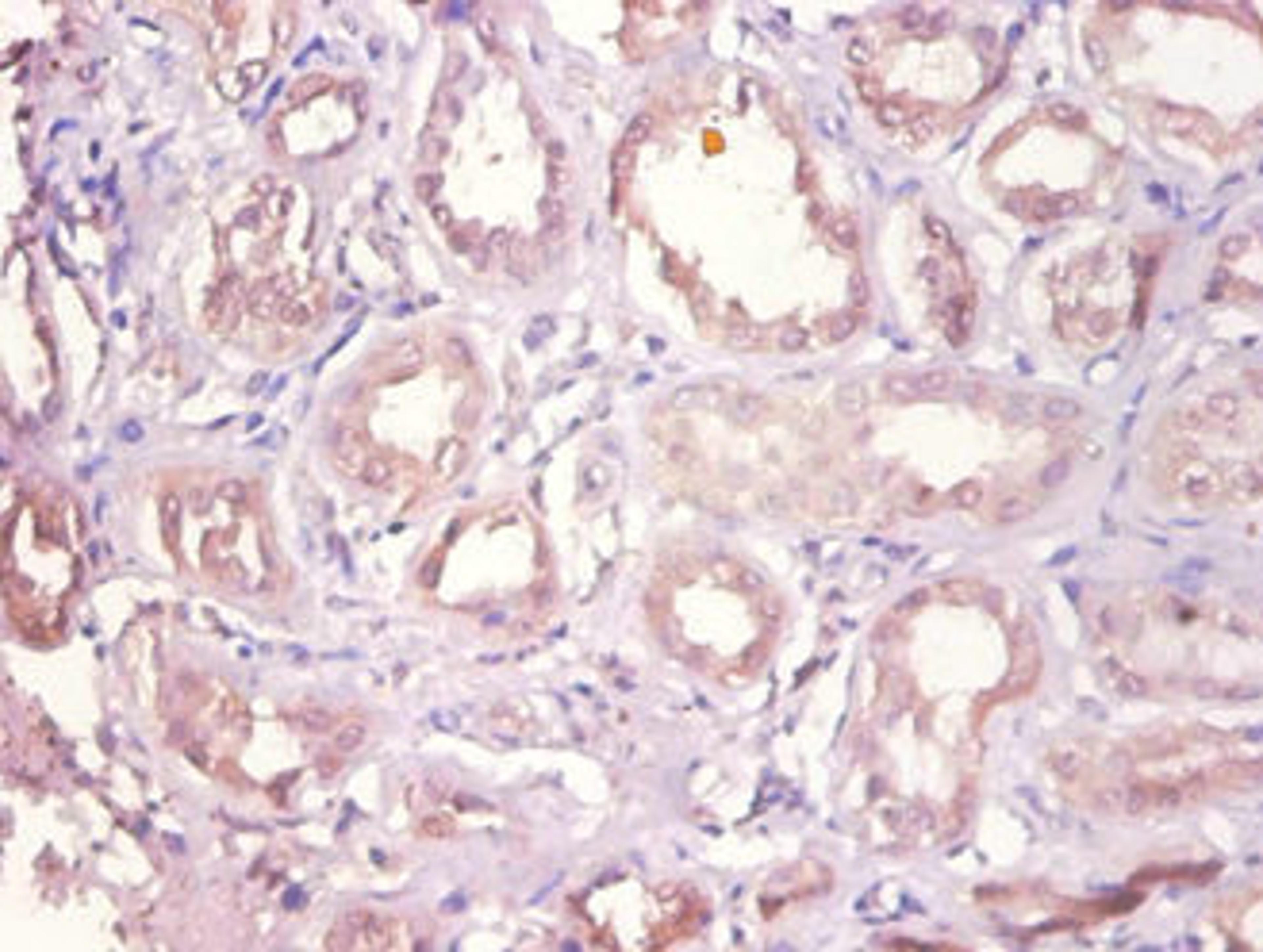 Immunohistochemistry of paraffin-embedded human kidney tissue using CSB-PA006867DA01HU at dilution of 1:100