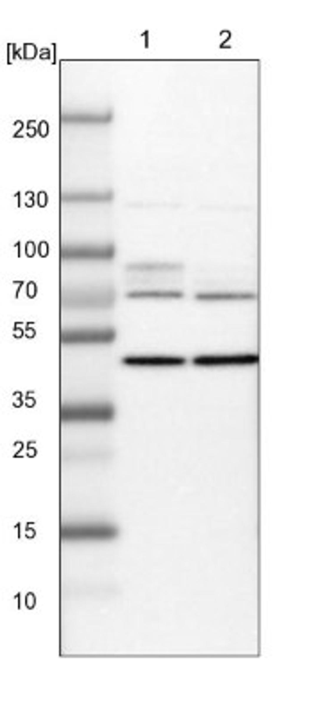 Western Blot: IGF2BP1 Antibody [NBP1-83108] - Lane 1: NIH-3T3 cell lysate (Mouse embryonic fibroblast cells)<br/>Lane 2: NBT-II cell lysate (Rat Wistar bladder tumour cells)