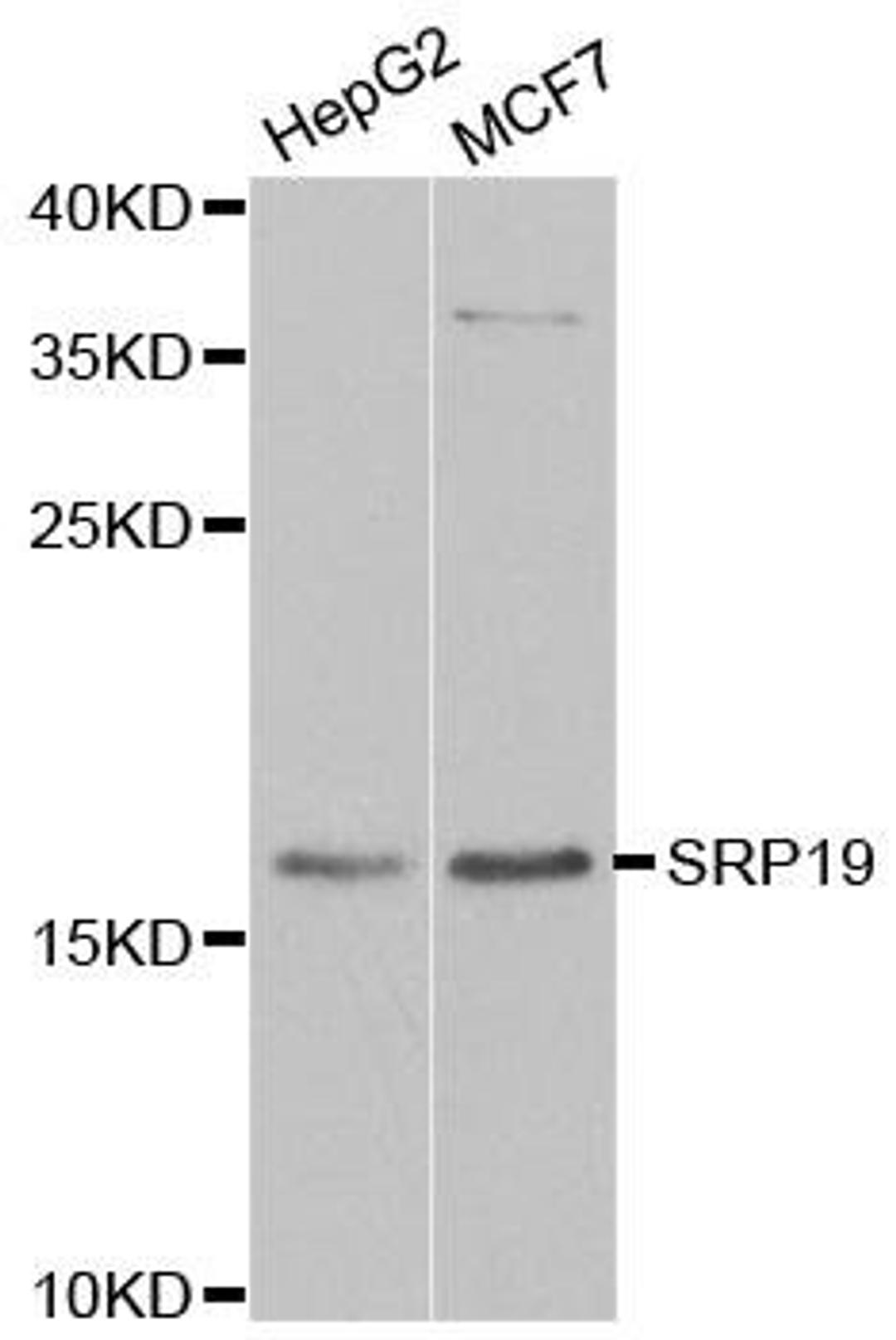 Western blot analysis of extracts of various cell lines using SRP19 antibody