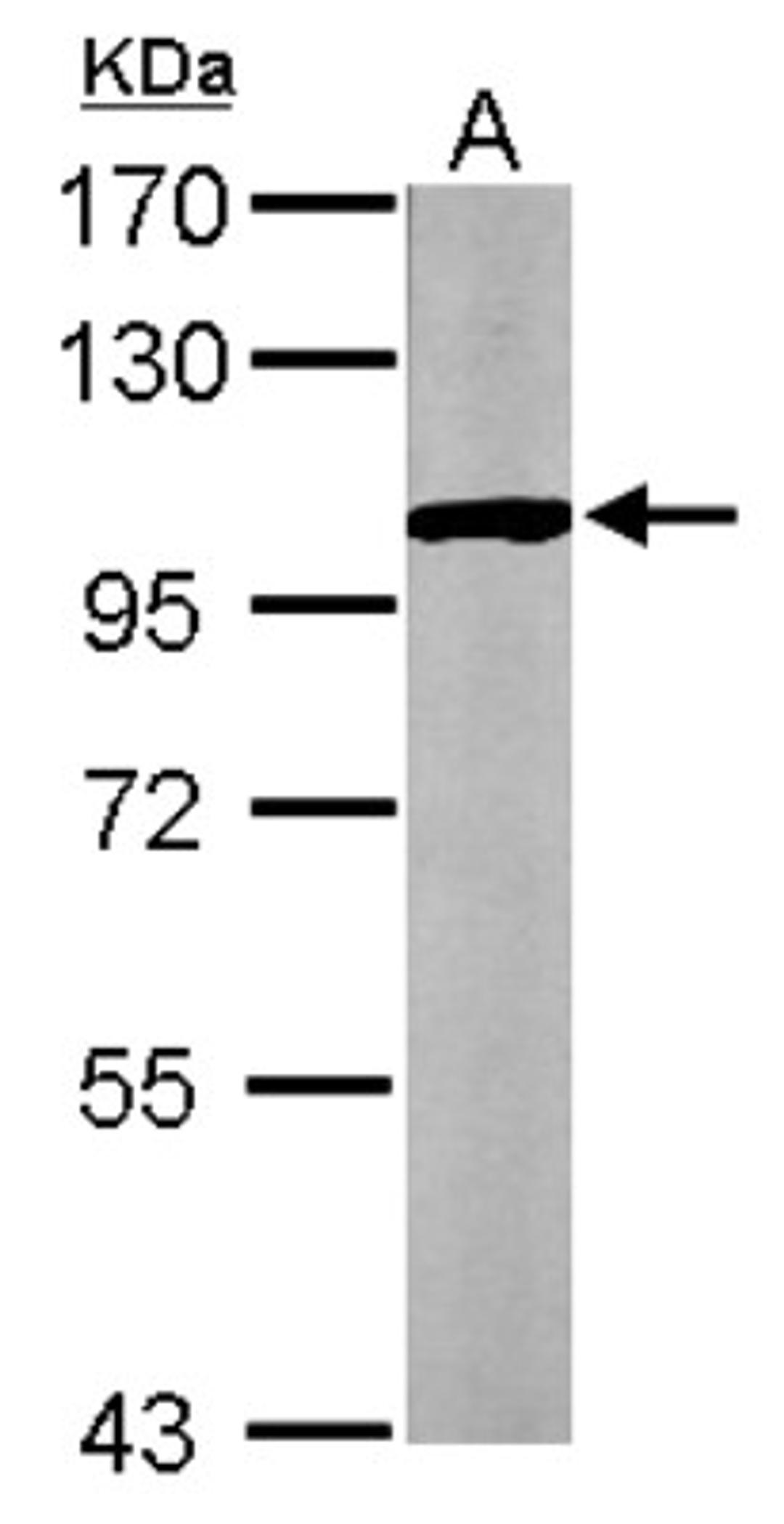 Western Blot: GPBB Antibody [NBP1-32799] - Sample (50 ug of whole cell lysate) A: Mouse brain 7. 5% SDS PAGE; antibody diluted at 1:1000.