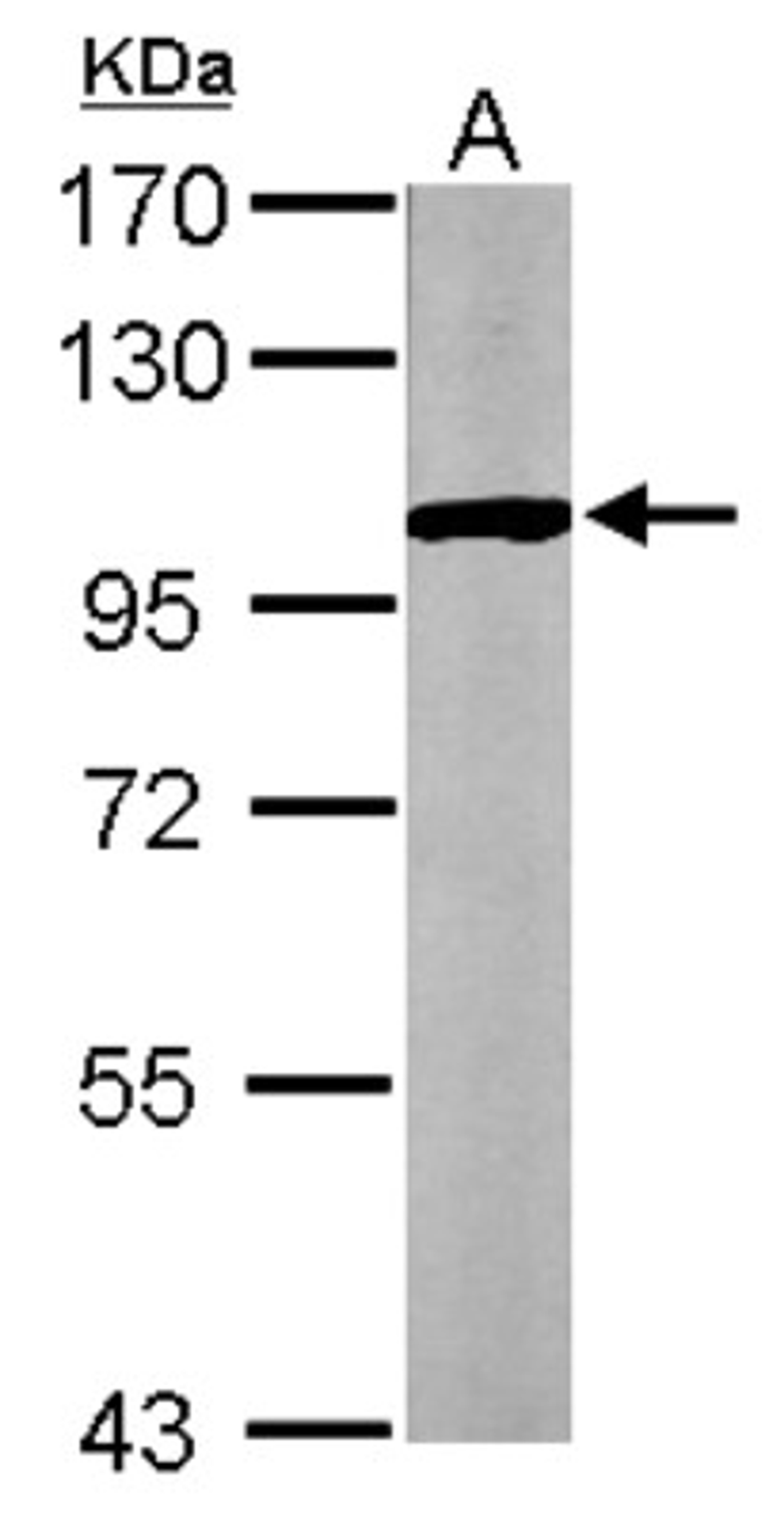 Western Blot: GPBB Antibody [NBP1-32799] - Sample (50 ug of whole cell lysate) A: Mouse brain 7. 5% SDS PAGE; antibody diluted at 1:1000.