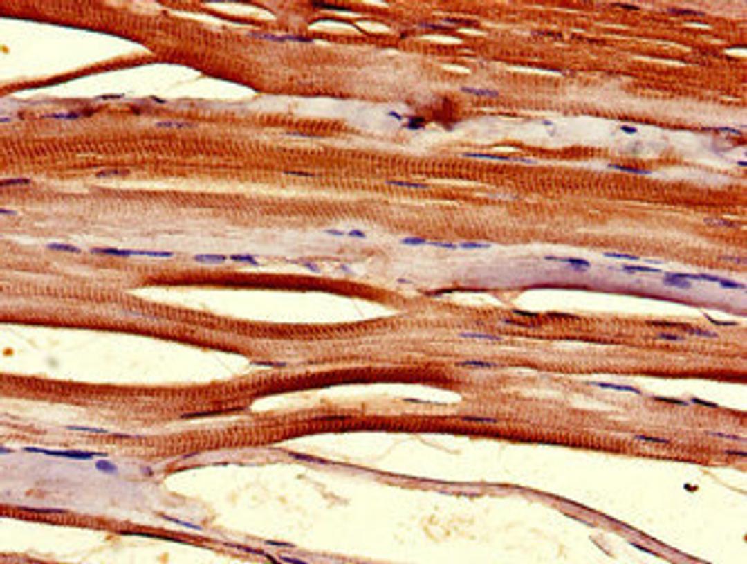 Immunohistochemistry of paraffin-embedded human skeletal muscle tissue using CSB-PA023951LA01HU at dilution of 1:100