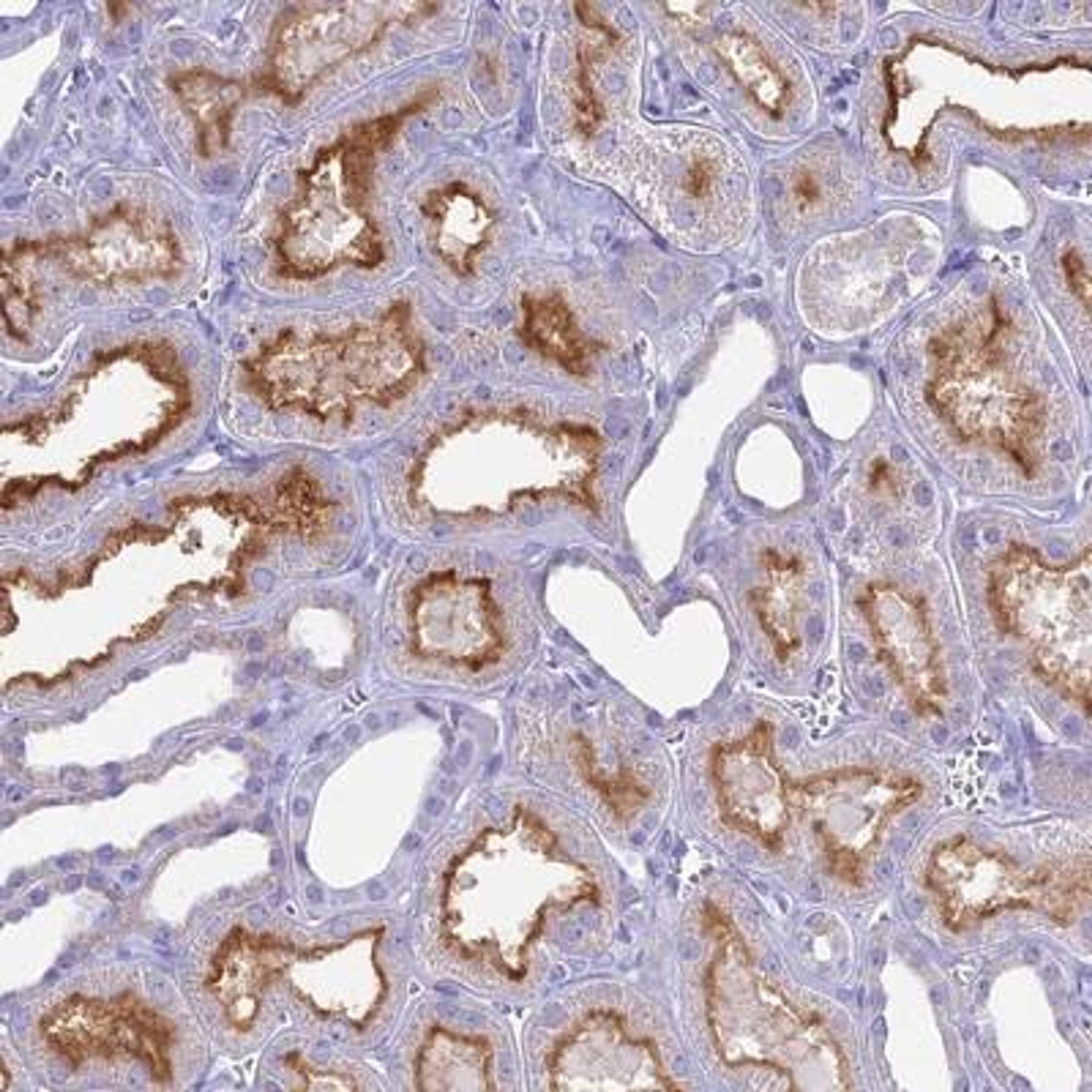 Immunohistochemistry: ACE/CD143 Antibody [NBP1-91666] - Staining of human kidney shows strong membranous positivity in cells in tubules.