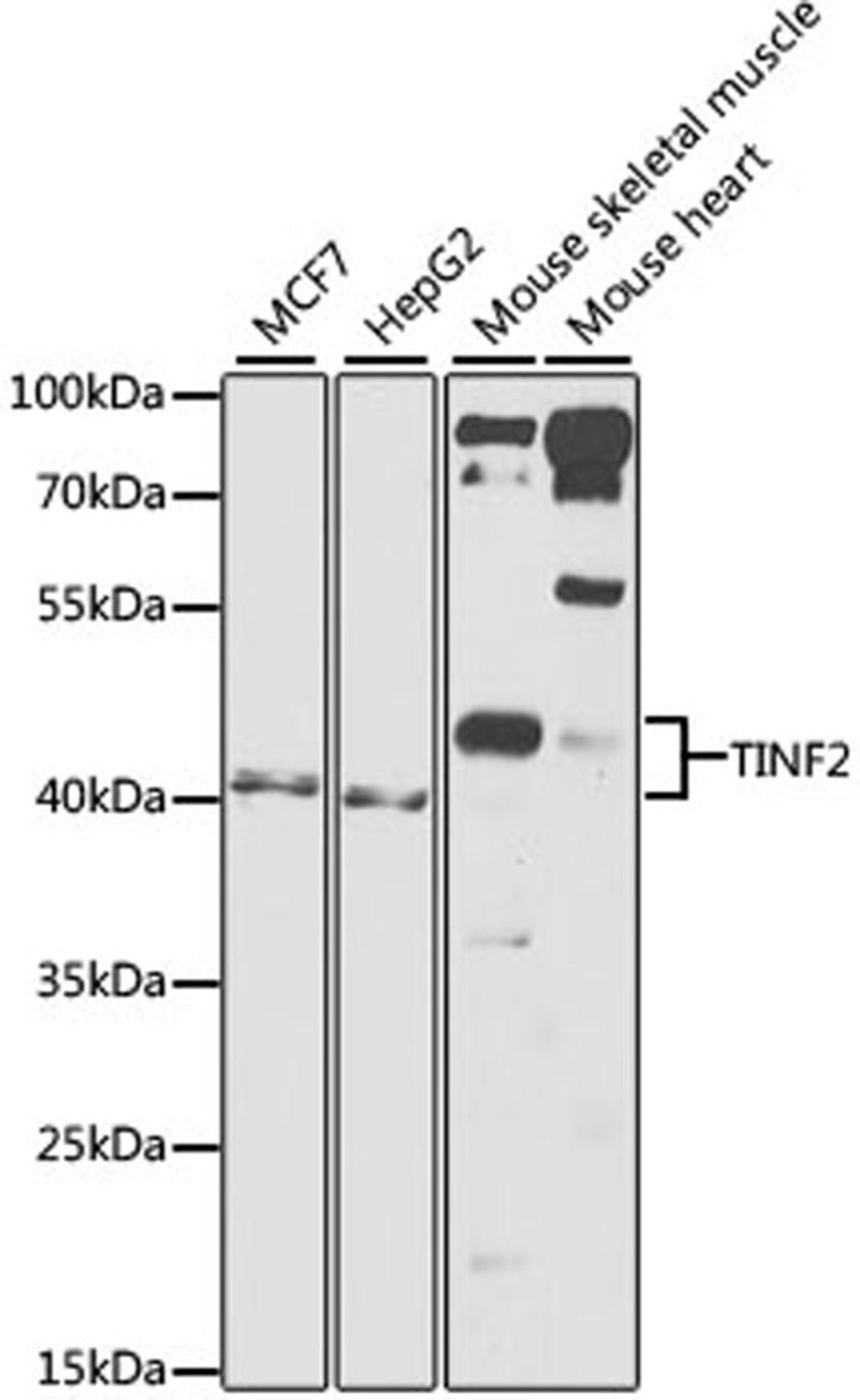 Western blot - TINF2 antibody (A6769)