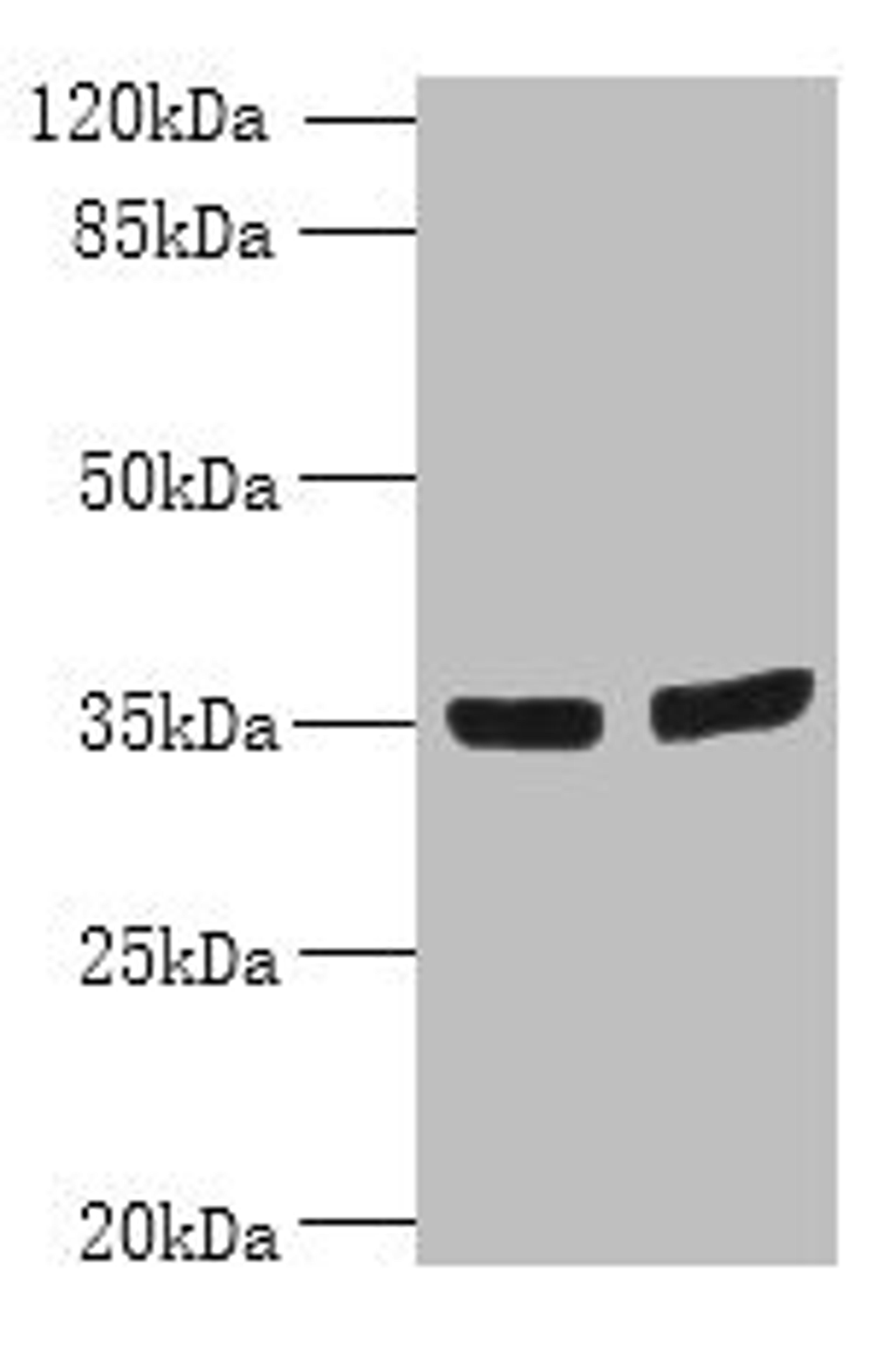 Western blot. All lanes: OSR2 antibody at 7µg/ml. Lane 1: Jurkat whole cell lysate. Lane 2: Hela whole cell lysate. Secondary. Goat polyclonal to rabbit IgG at 1/10000 dilution. Predicted band size: 36, 31, 49 kDa. Observed band size: 36 kDa