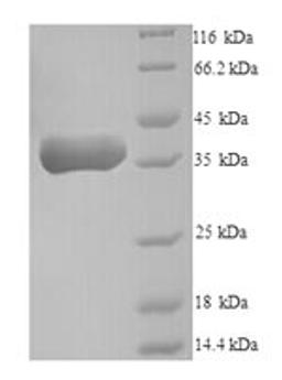 (Tris-Glycine gel) Discontinuous SDS-PAGE (reduced) with 5% enrichment gel and 15% separation gel.