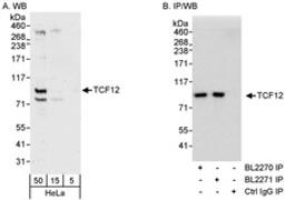 Detection of human TCF12 by western blot and immunoprecipitation.