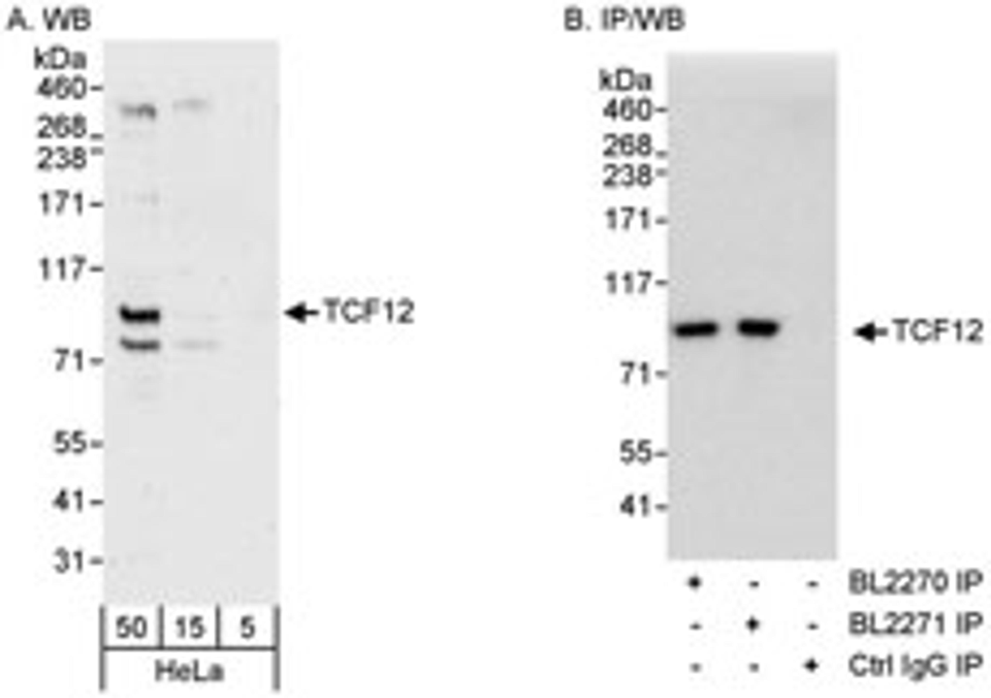 Detection of human TCF12 by western blot and immunoprecipitation.