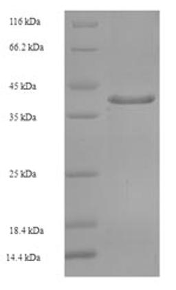 (Tris-Glycine gel) Discontinuous SDS-PAGE (reduced) with 5% enrichment gel and 15% separation gel.