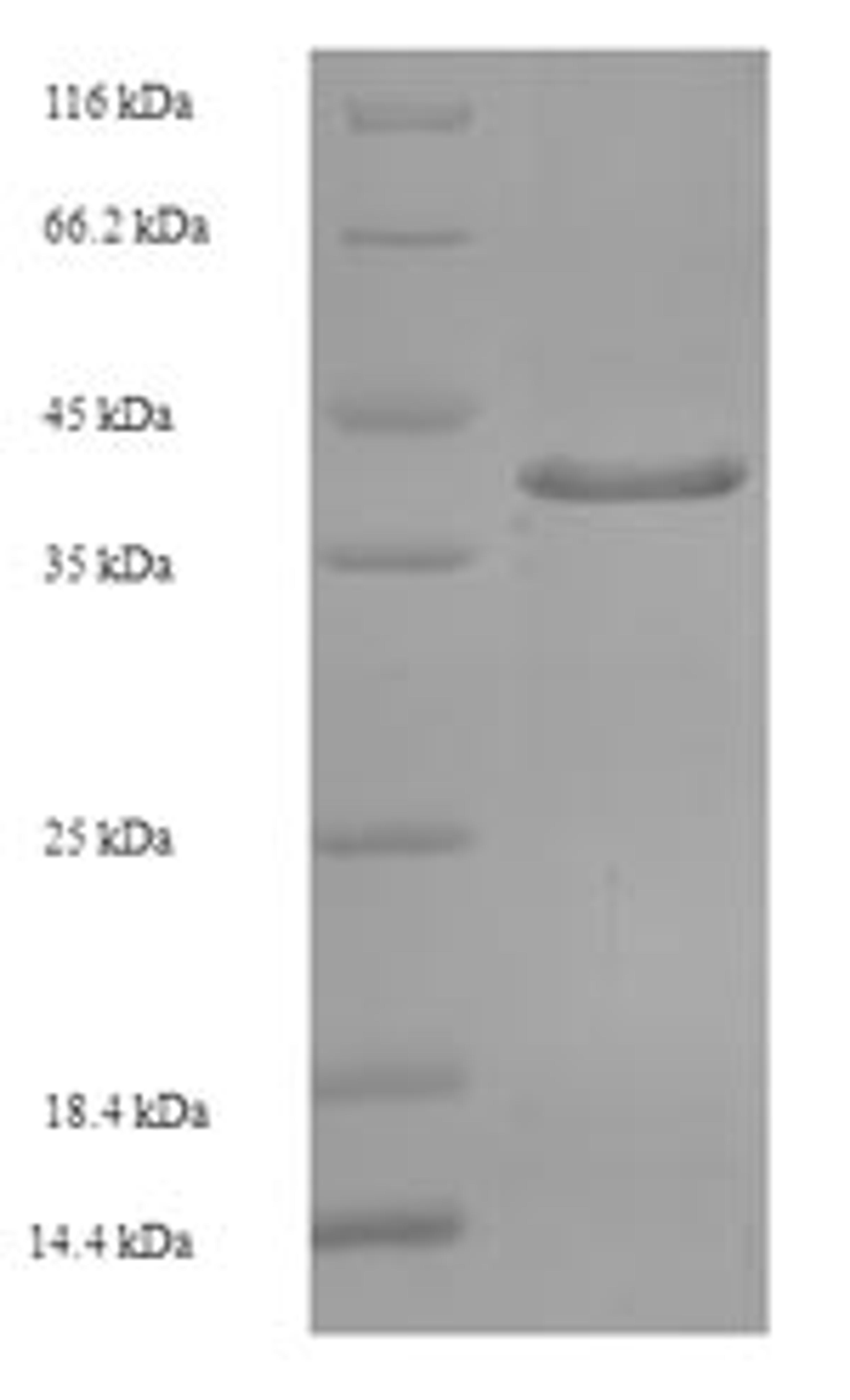 (Tris-Glycine gel) Discontinuous SDS-PAGE (reduced) with 5% enrichment gel and 15% separation gel.