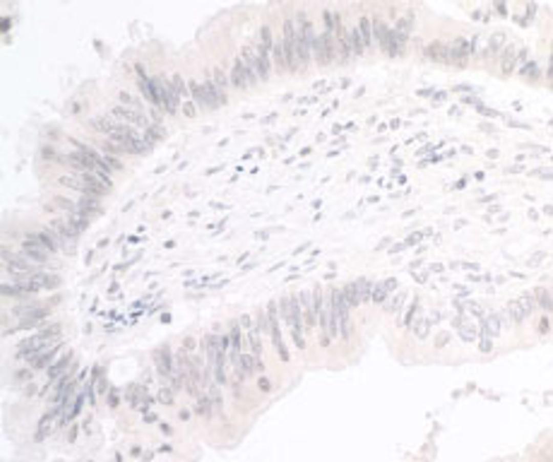 Detection of human PIMT by immunohistochemistry.