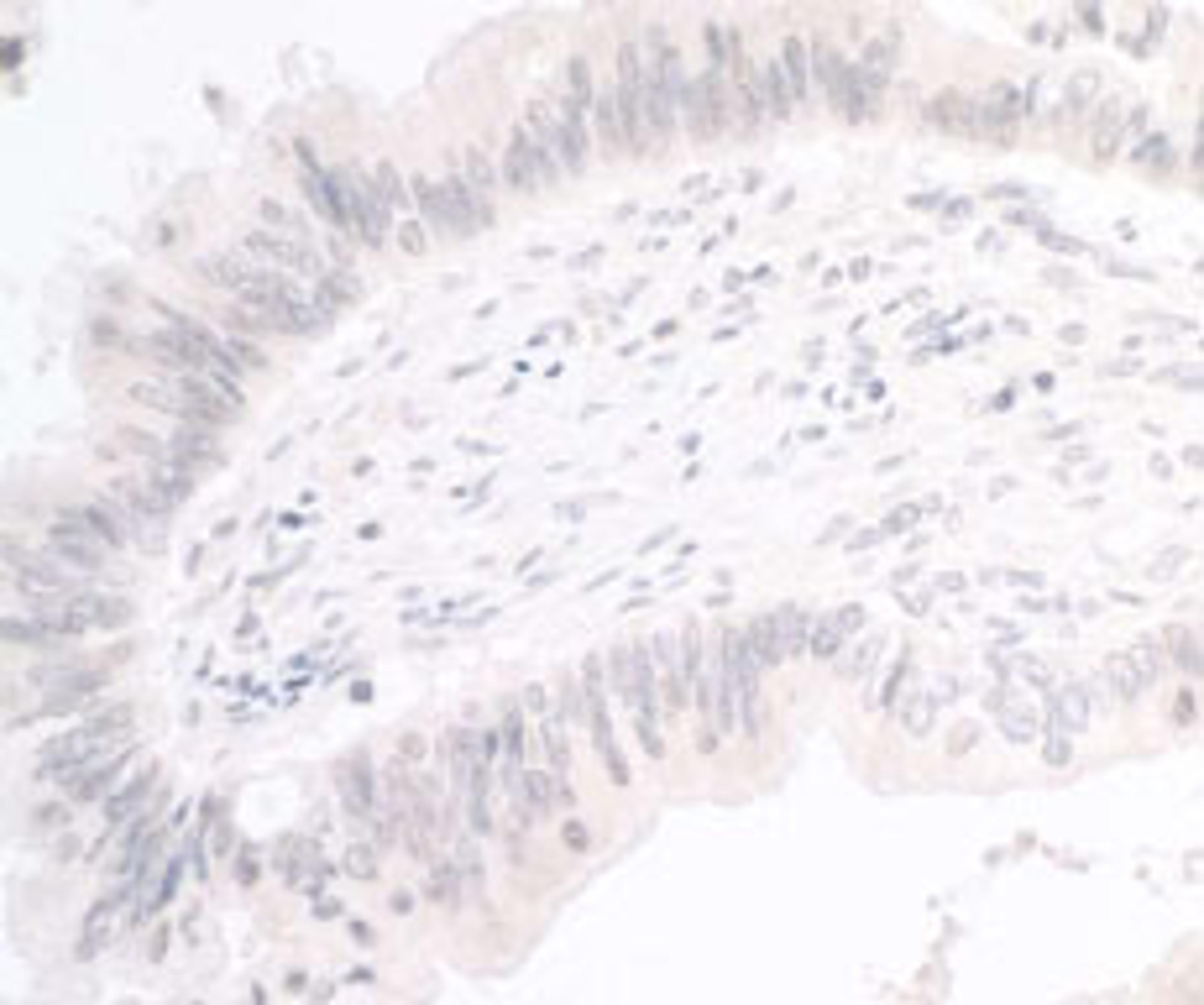 Detection of human PIMT by immunohistochemistry.