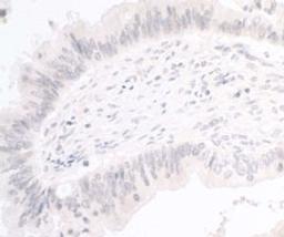 Detection of human PIMT by immunohistochemistry.