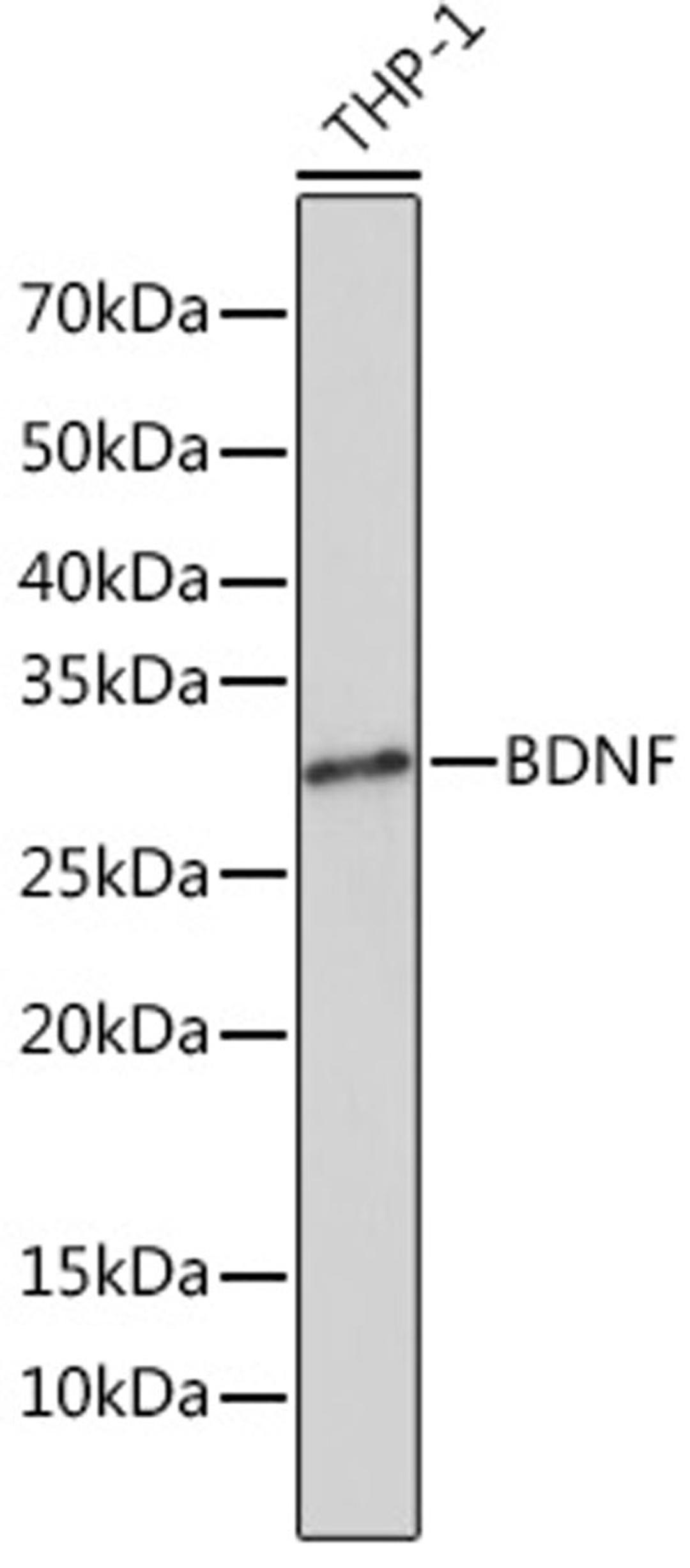 Western blot - BDNF Rabbit mAb (A4873)