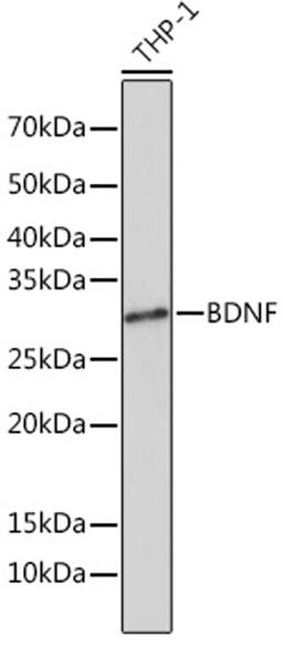 Western blot - BDNF Rabbit mAb (A4873)