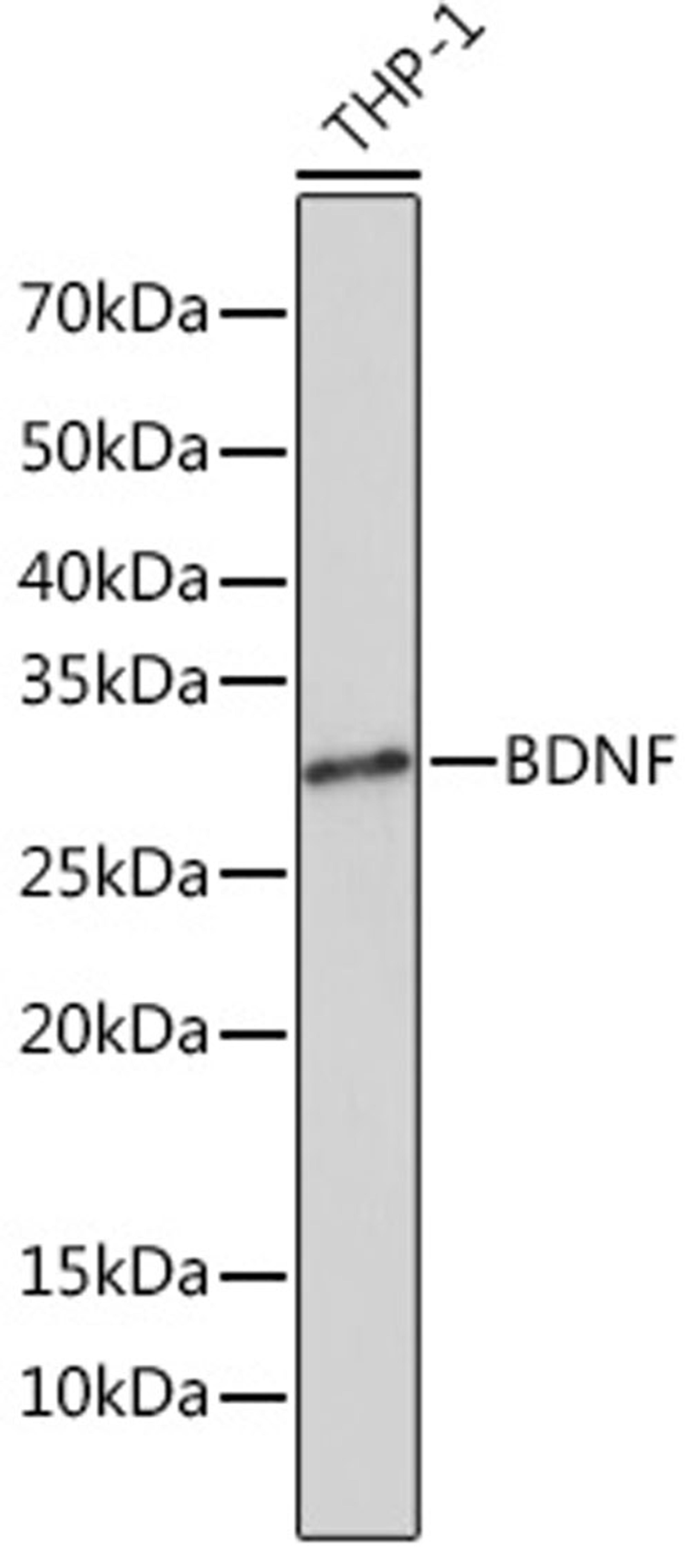 Western blot - BDNF Rabbit mAb (A4873)