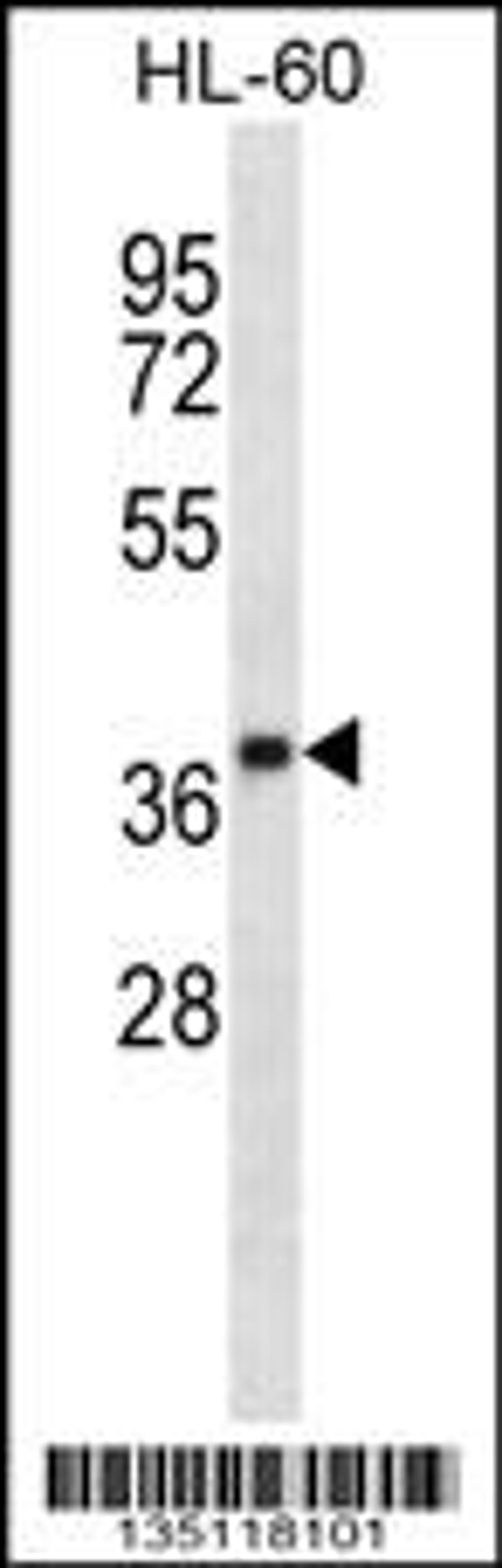 Western blot analysis in HL-60 cell line lysates (35ug/lane).