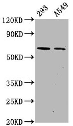 Western Blot. Positive WB detected in 293 whole cell lysate锛孉549 whole cell lysate. All lanes Phospho-PRKAA2 antibody at 1.1μg/ml. Secondary. Goat polyclonal to rabbit IgG at 1/50000 dilution. Predicted band size: 62 KDa. Observed band size: 62 KDa. 