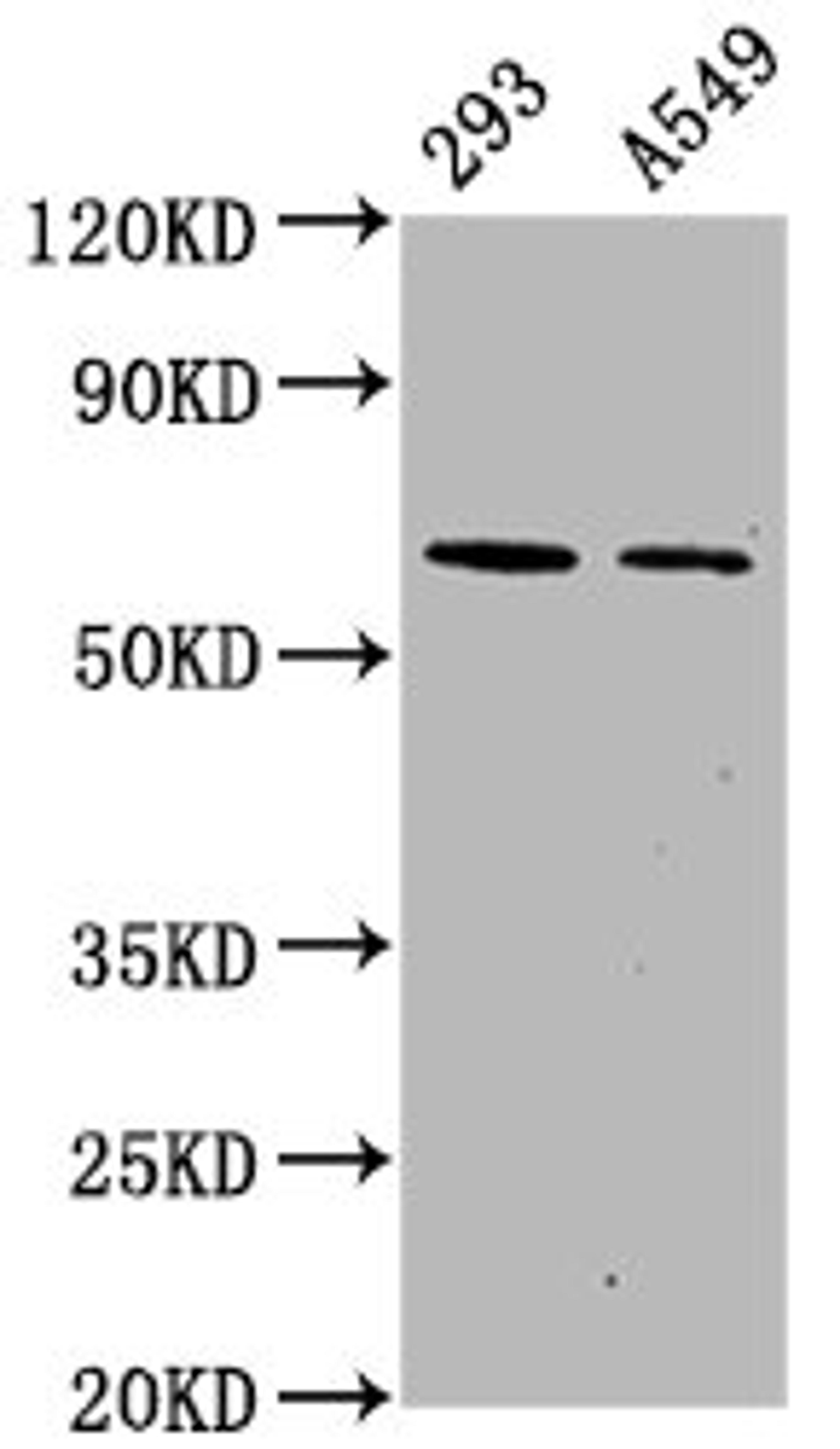 Western Blot. Positive WB detected in 293 whole cell lysate锛孉549 whole cell lysate. All lanes Phospho-PRKAA2 antibody at 1.1μg/ml. Secondary. Goat polyclonal to rabbit IgG at 1/50000 dilution. Predicted band size: 62 KDa. Observed band size: 62 KDa. 