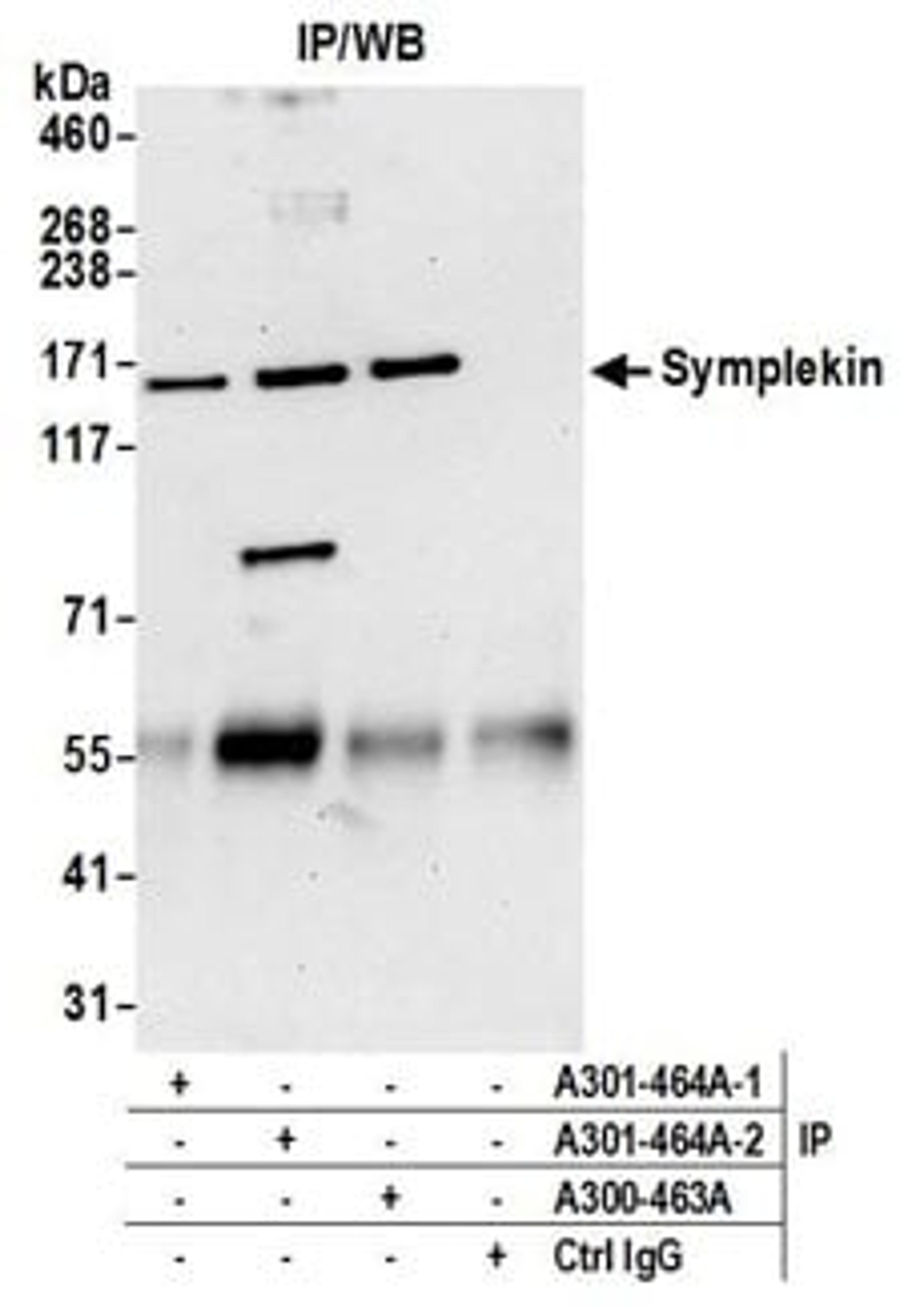 Detection of human Symplekin by western blot of immunoprecipitates.