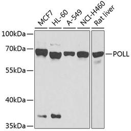 Western blot - POLL antibody (A8408)