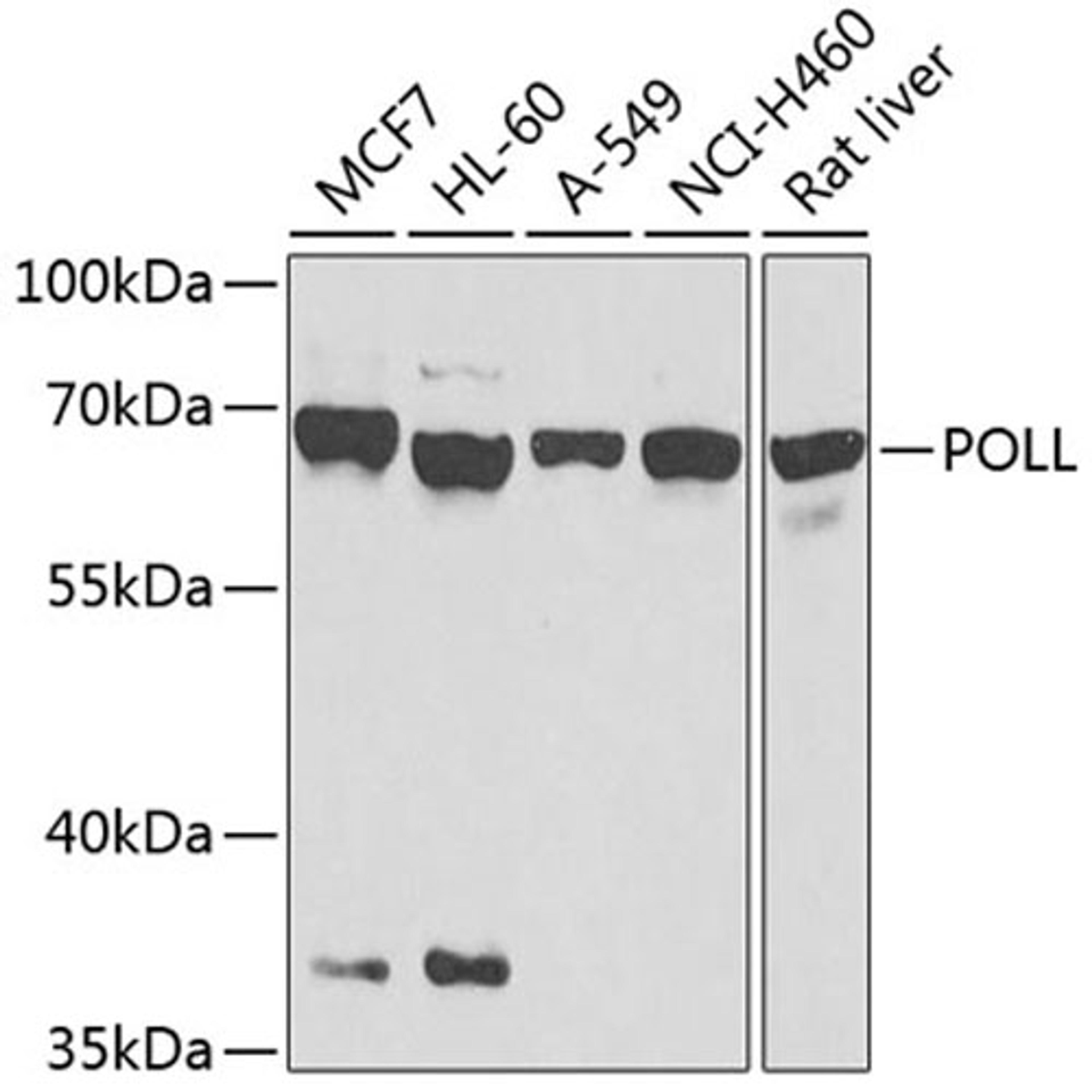 Western blot - POLL antibody (A8408)