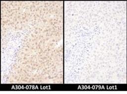 Detection of mouse WWOX by immunohistochemistry.