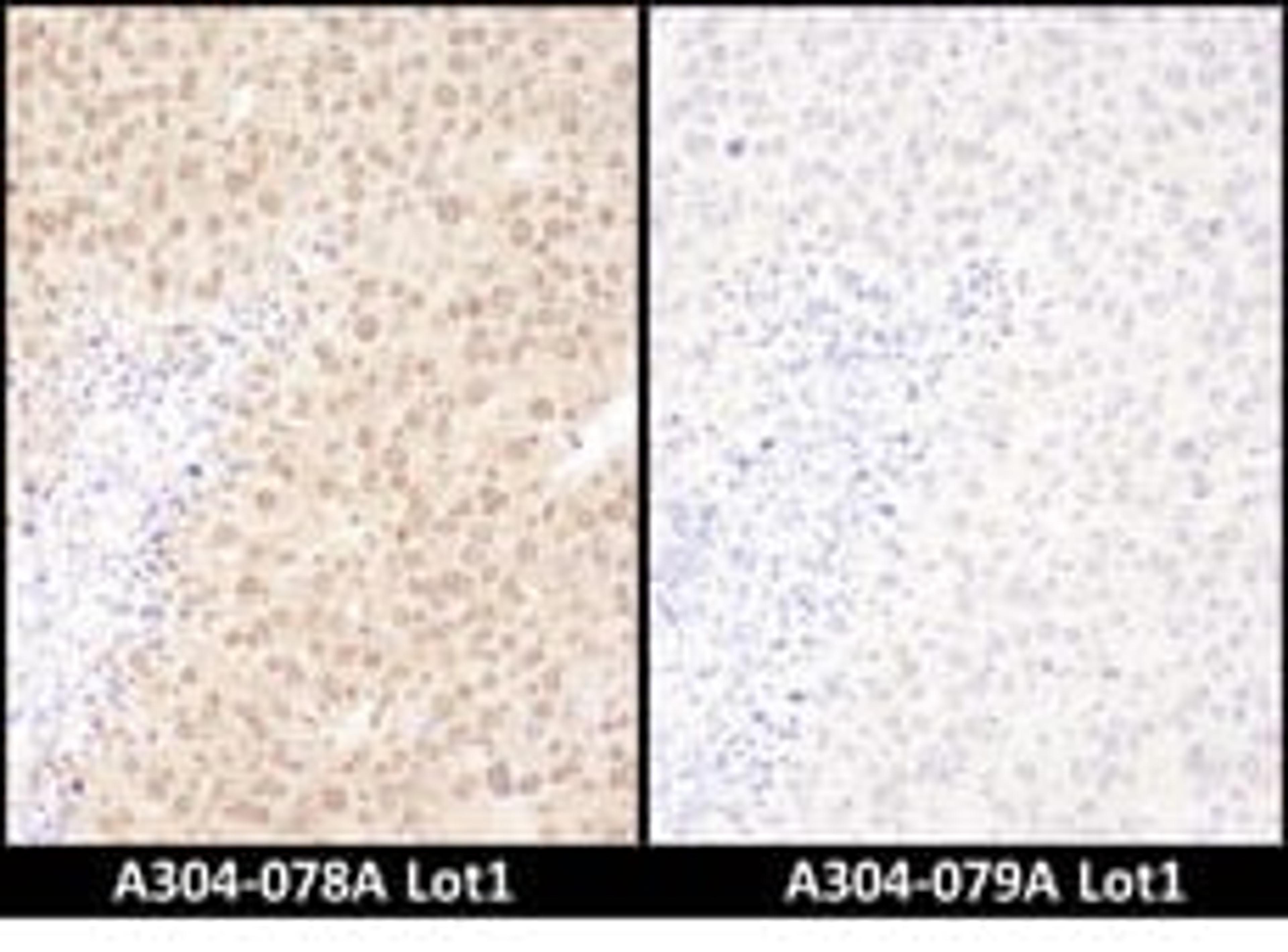 Detection of mouse WWOX by immunohistochemistry.