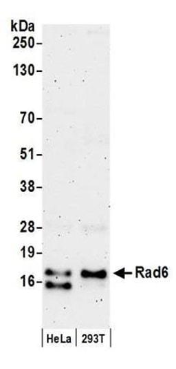 Detection of human Rad6 by western blot.