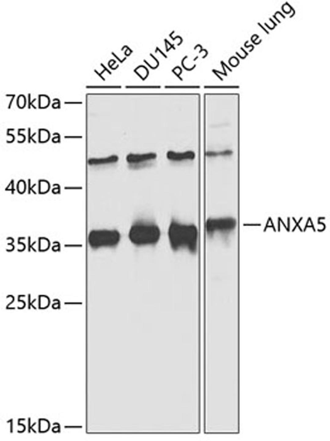 Western blot - ANXA5 antibody (A13945)