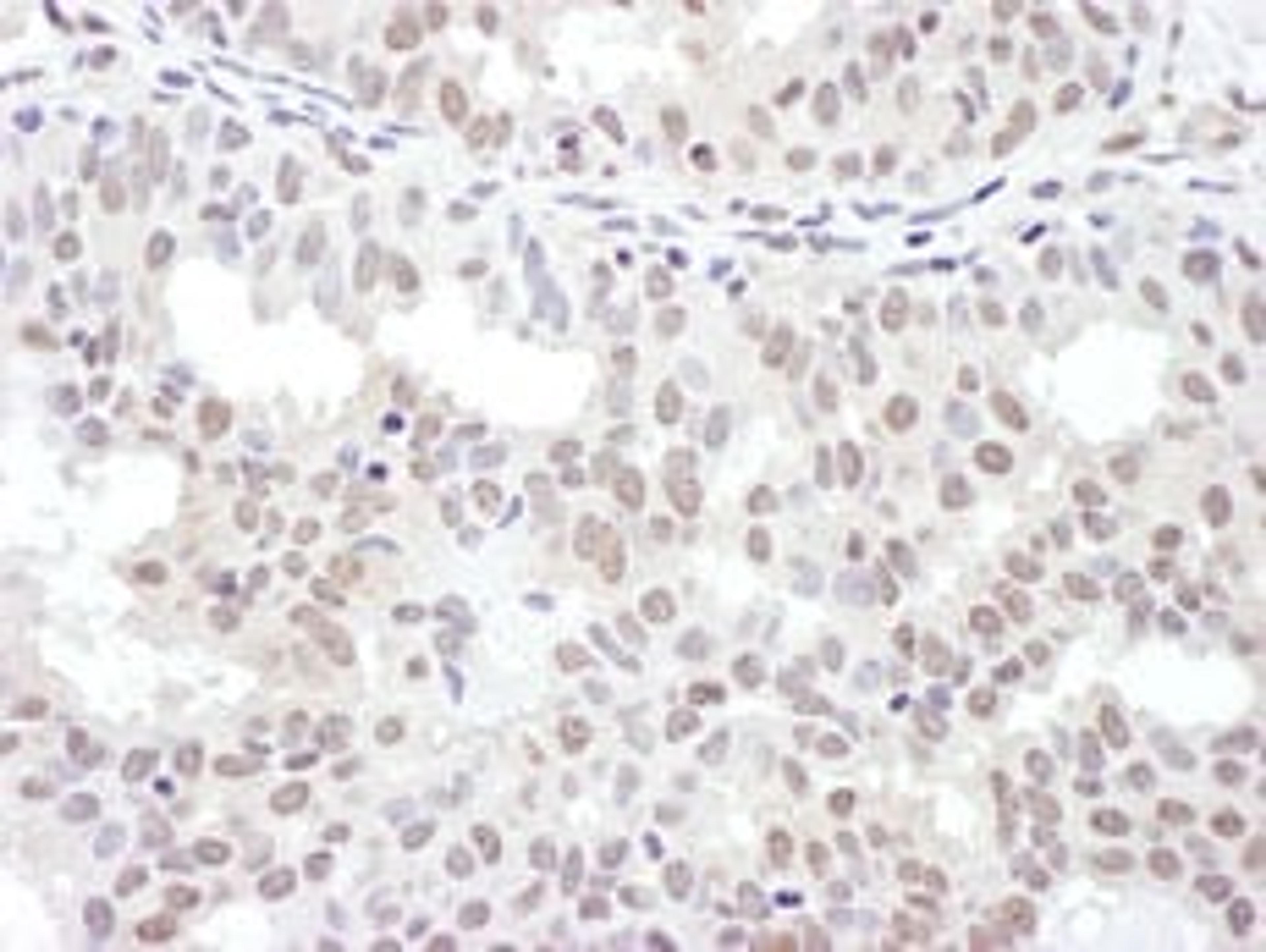 Detection of human NRF by immunohistochemistry.