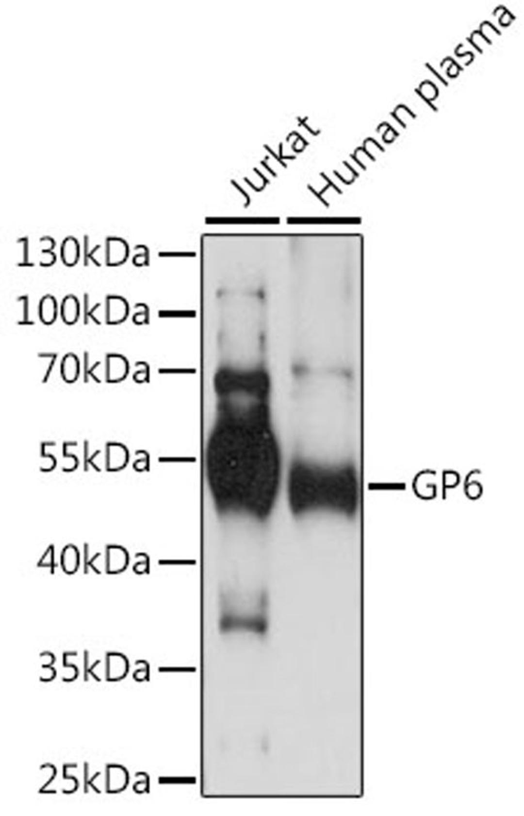 Western blot - GP6 antibody (A14999)