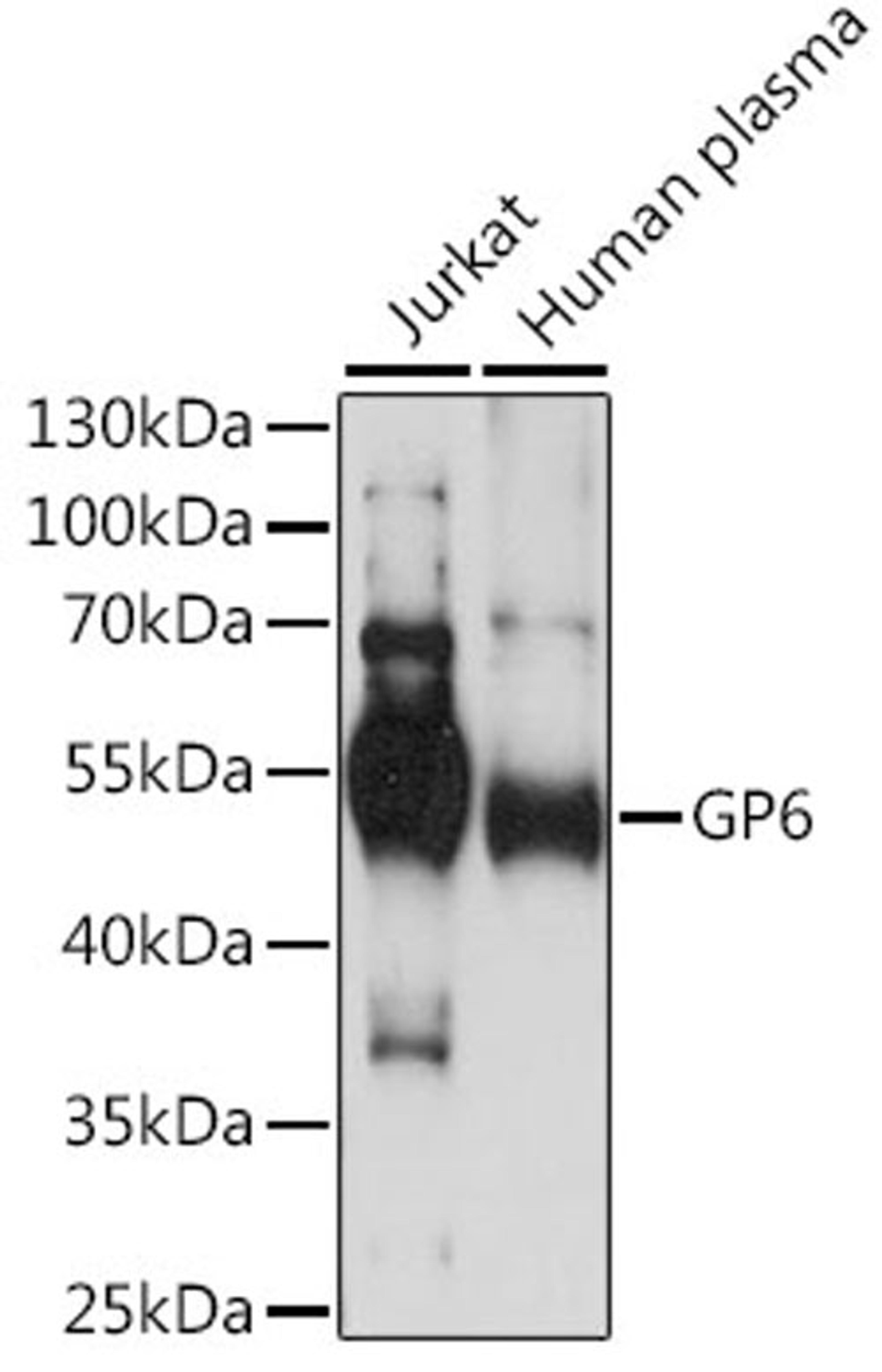 Western blot - GP6 antibody (A14999)