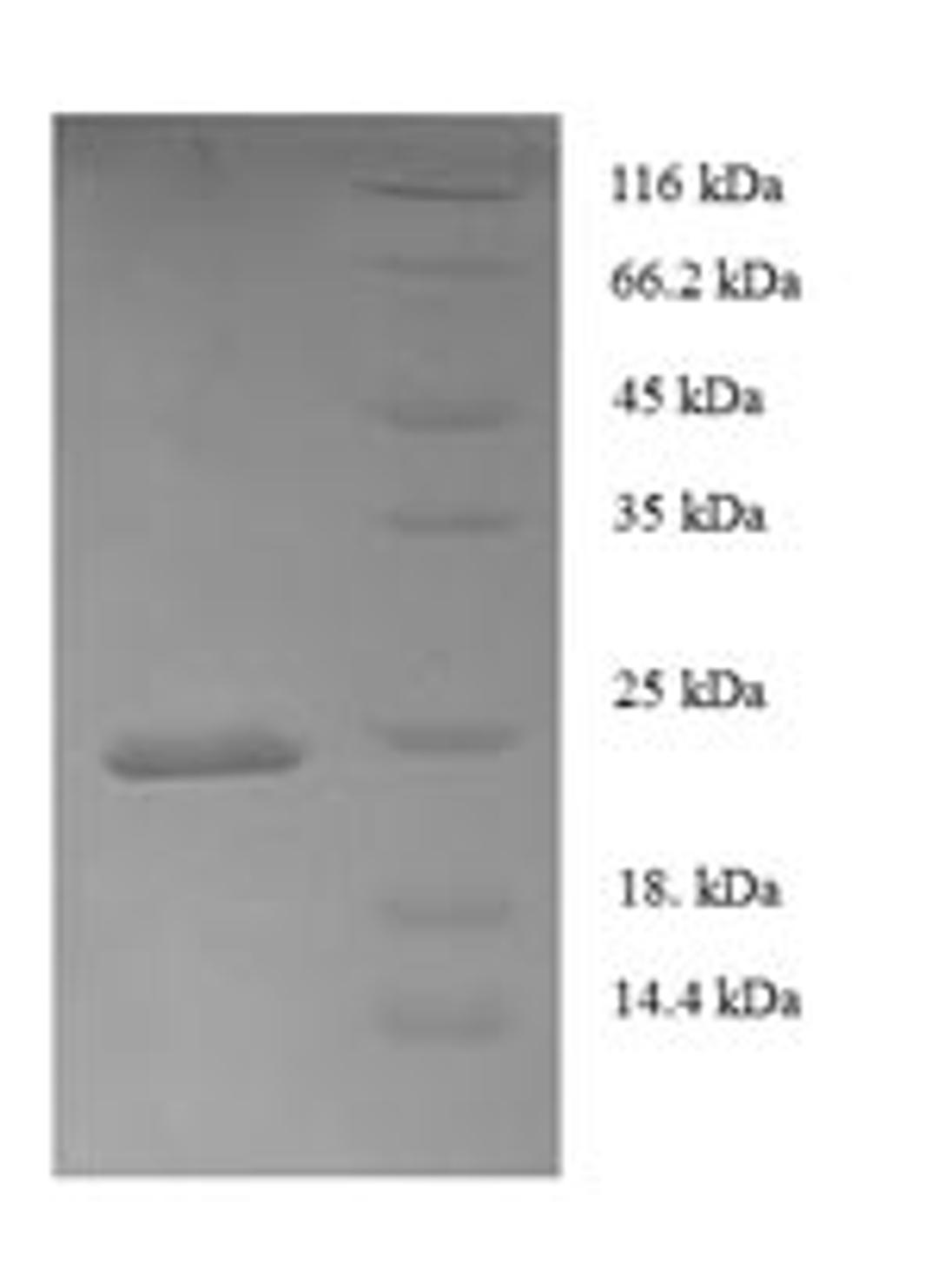(Tris-Glycine gel) Discontinuous SDS-PAGE (reduced) with 5% enrichment gel and 15% separation gel.