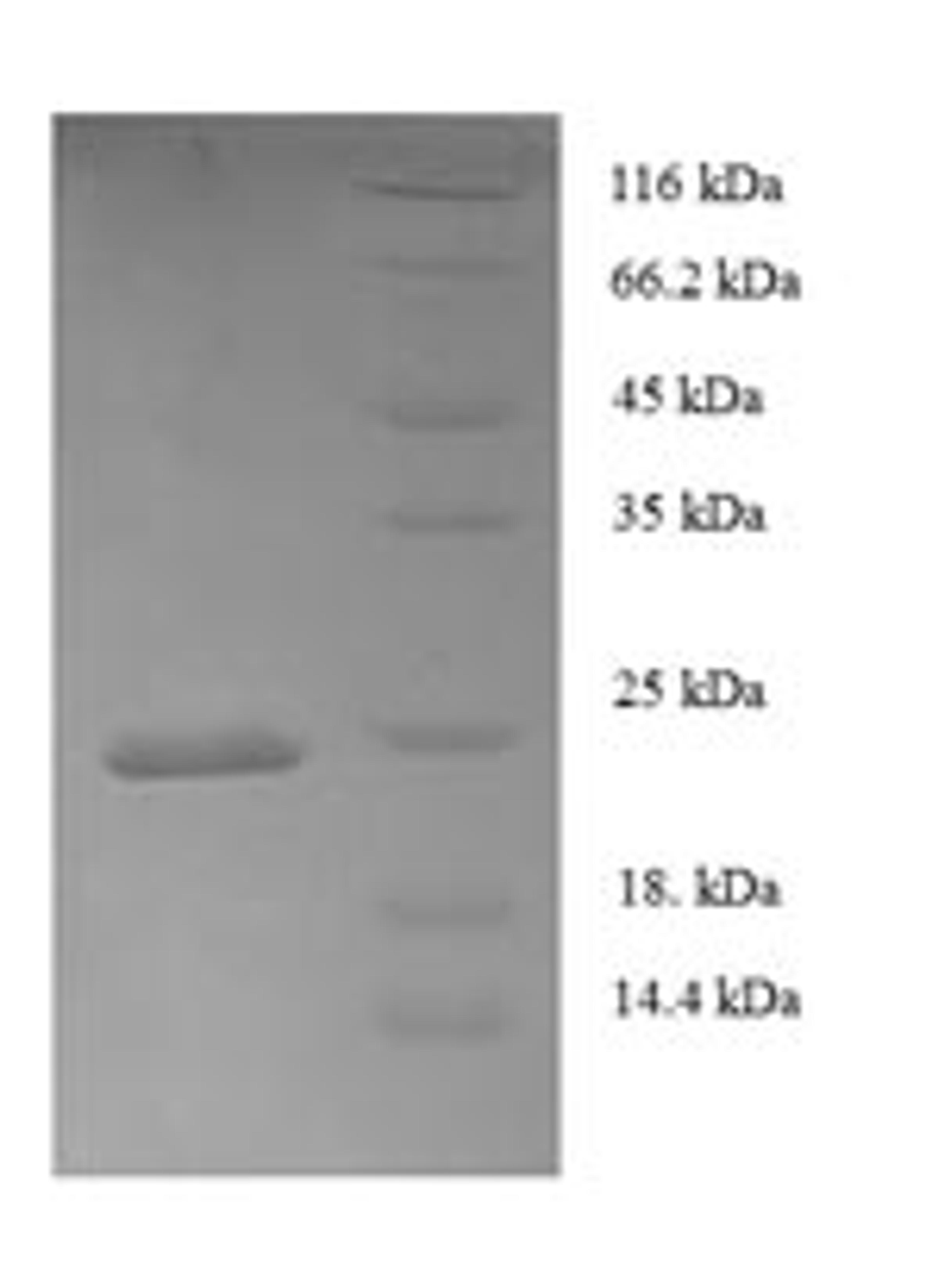 (Tris-Glycine gel) Discontinuous SDS-PAGE (reduced) with 5% enrichment gel and 15% separation gel.