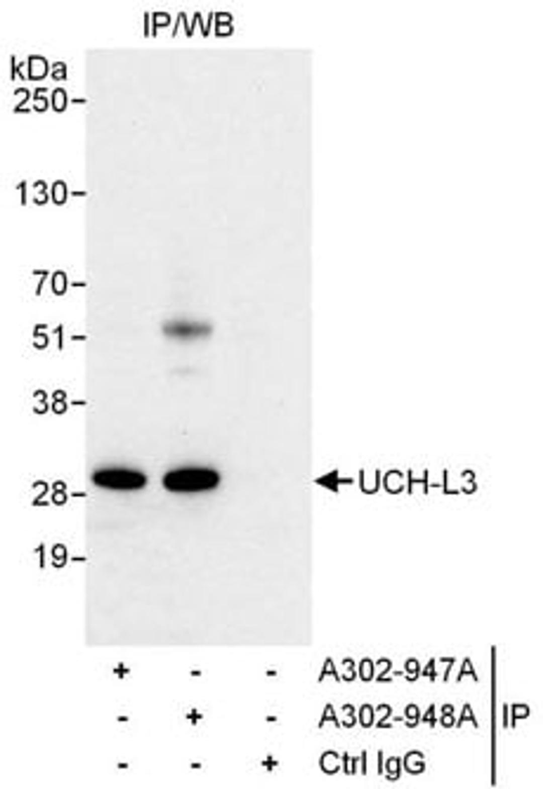 Detection of human UCH-L3 by western blot of immunoprecipitates.