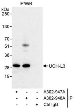 Detection of human UCH-L3 by western blot of immunoprecipitates.