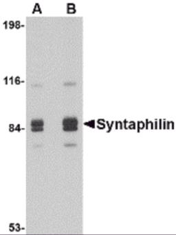 Western blot analysis of Syntaphilin in rat brain tissue lysate with Syntaphilin antibody at (A) 1 and (B) 2 &#956;g/mL.