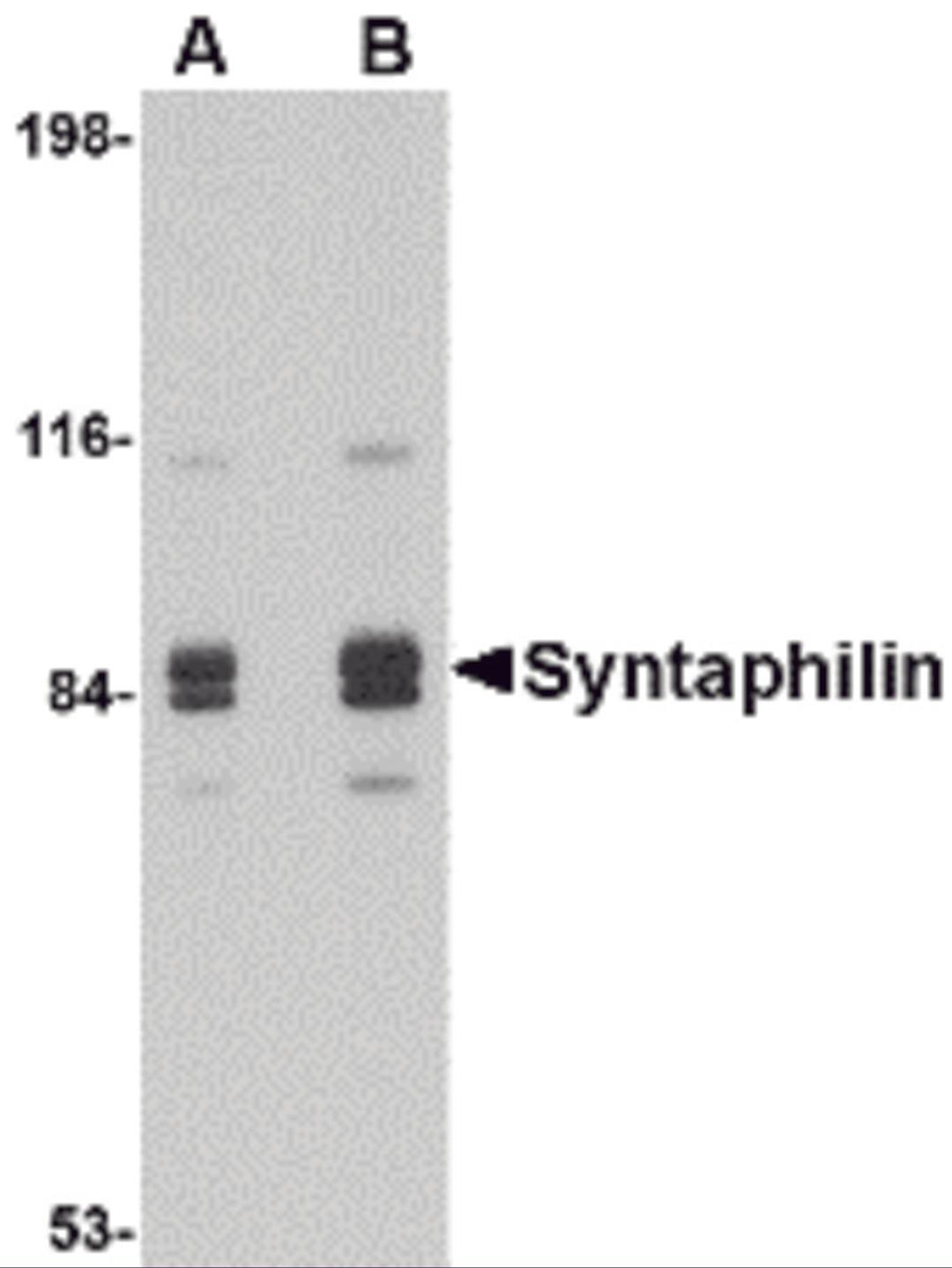 Western blot analysis of Syntaphilin in rat brain tissue lysate with Syntaphilin antibody at (A) 1 and (B) 2 μg/mL.