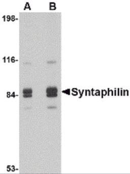 Western blot analysis of Syntaphilin in rat brain tissue lysate with Syntaphilin antibody at (A) 1 and (B) 2 μg/mL.